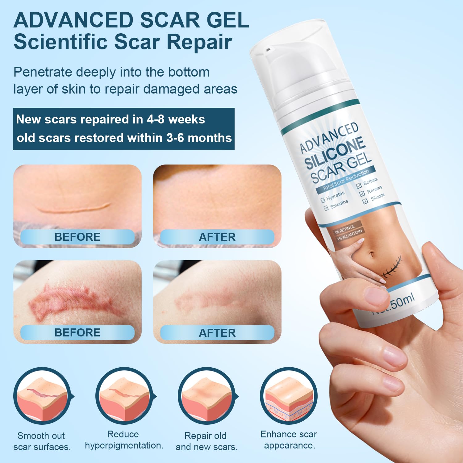 Detalle de Mitgary Silicone Scar Gel 50g
