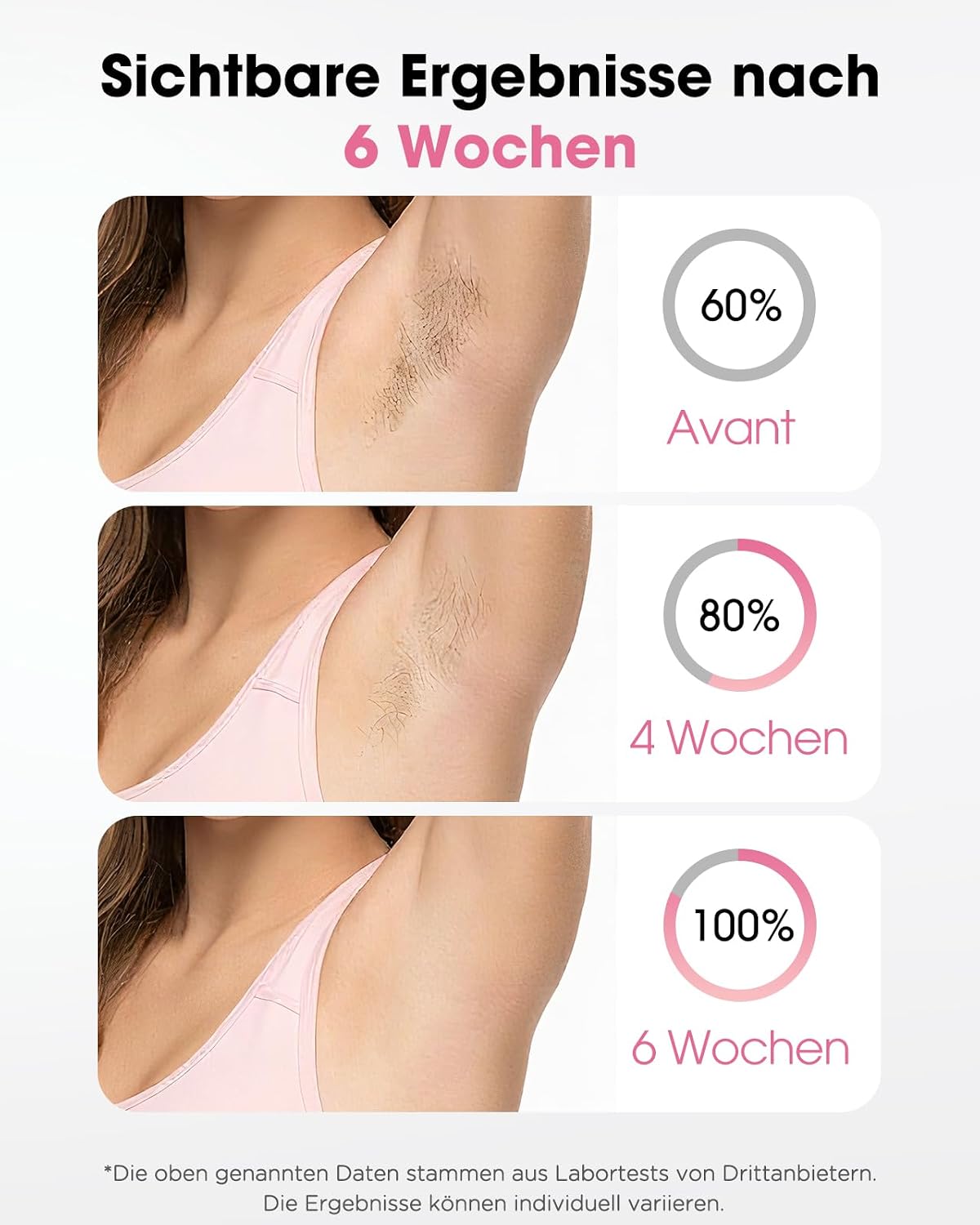 Thumbnail 2 de TIIMAGIC IPL Haarentfernung – Schmerzfreies Gerät mit 9 Stufen und 999900 Lichtimpulsen für Gesicht, Achseln, Bikini, Beine
