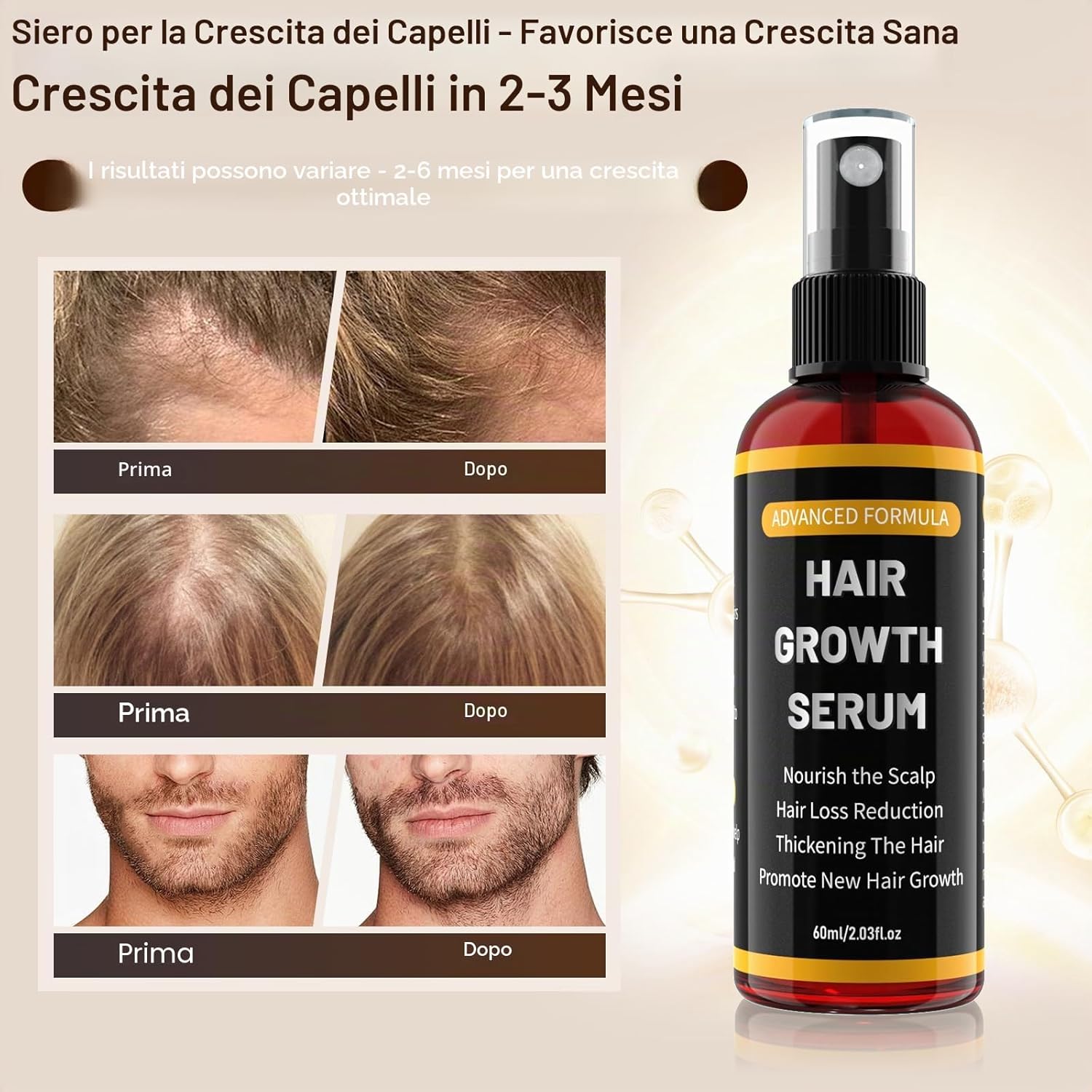 Detalle de Spray Siero per la Crescita dei Capelli 60 ml con Olio di Rosmarino, Olio di Ricino e Biotina
