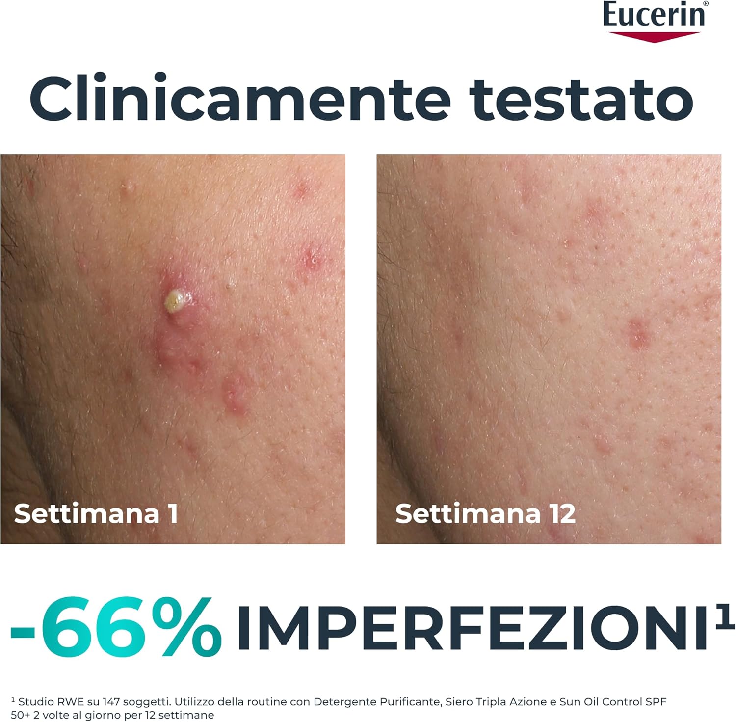 Thumbnail 1 de Eucerin DermoPure Clinical Siero Viso Tripla Azione con Thiamidol e Acido Salicilico 40 ml