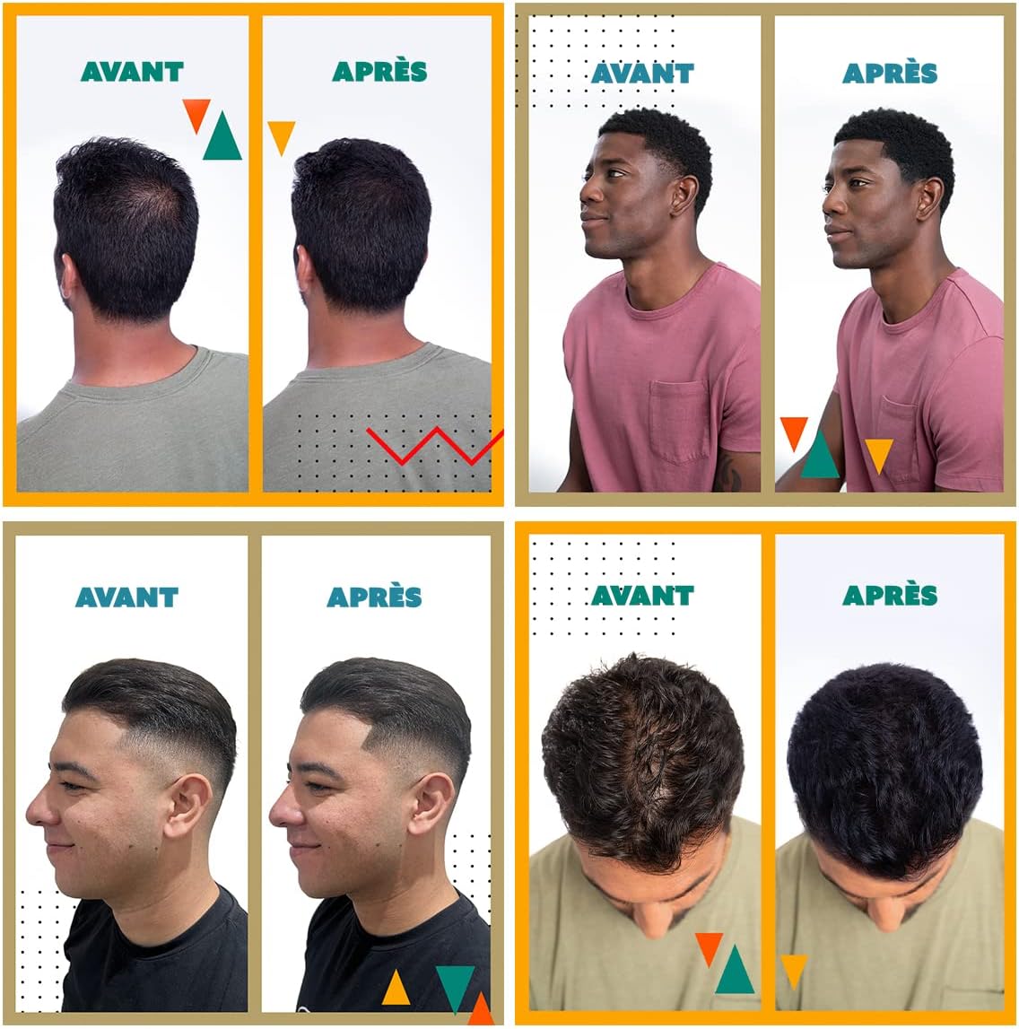 Detalle de TOPPIK Fibres capillaires densifiantes à la kératine (Blond) – fibres pour racines, ligne frontale et barbe