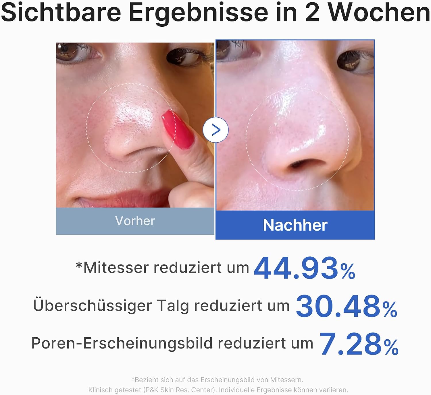 Detalle de Medicube Zero Pore Pad 2.0 – Peeling-Tonerpads für Porenpflege