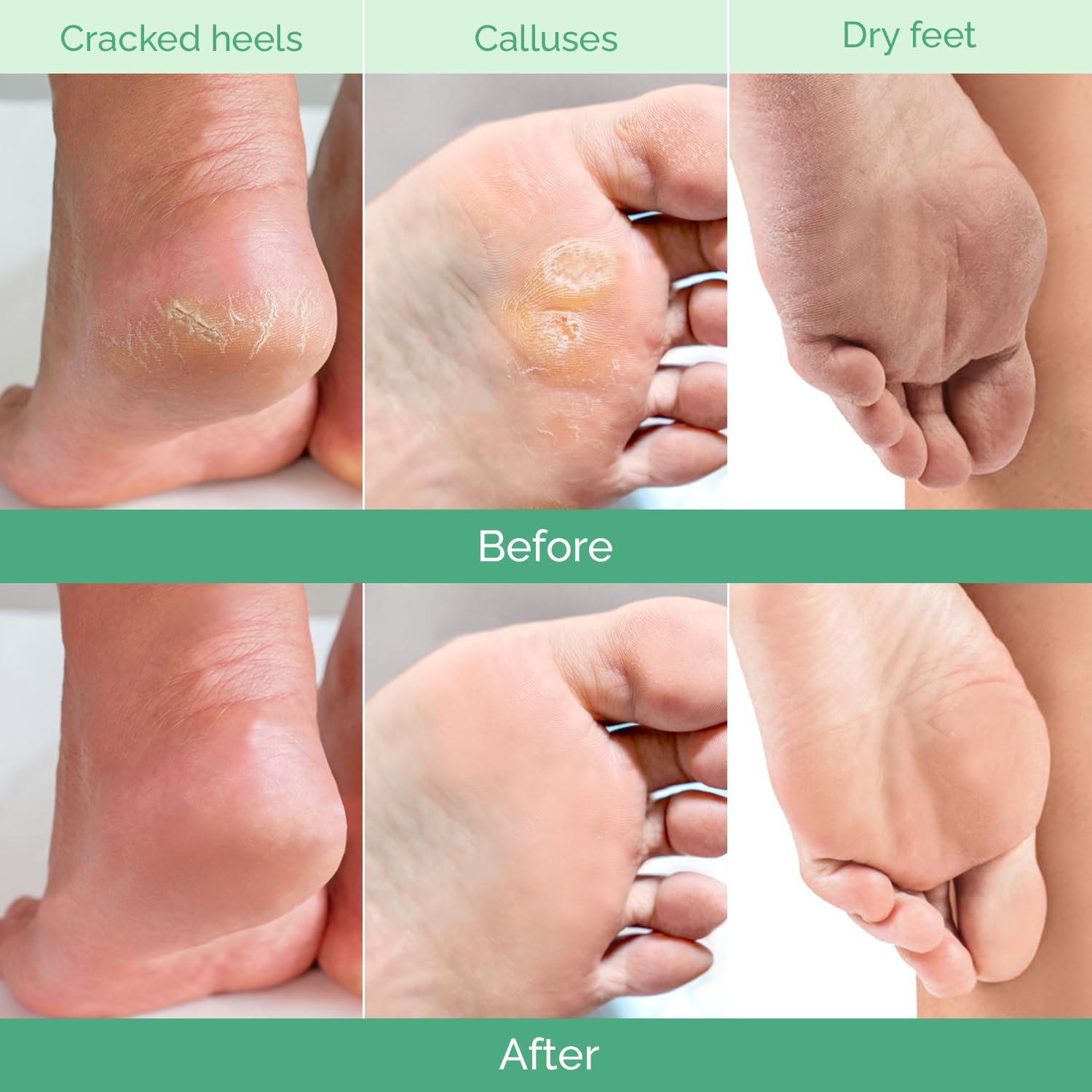 Detalle 2 de PLANTIFIQUE Foot Peeling Mask for Baby-Soft Heels 🦶
