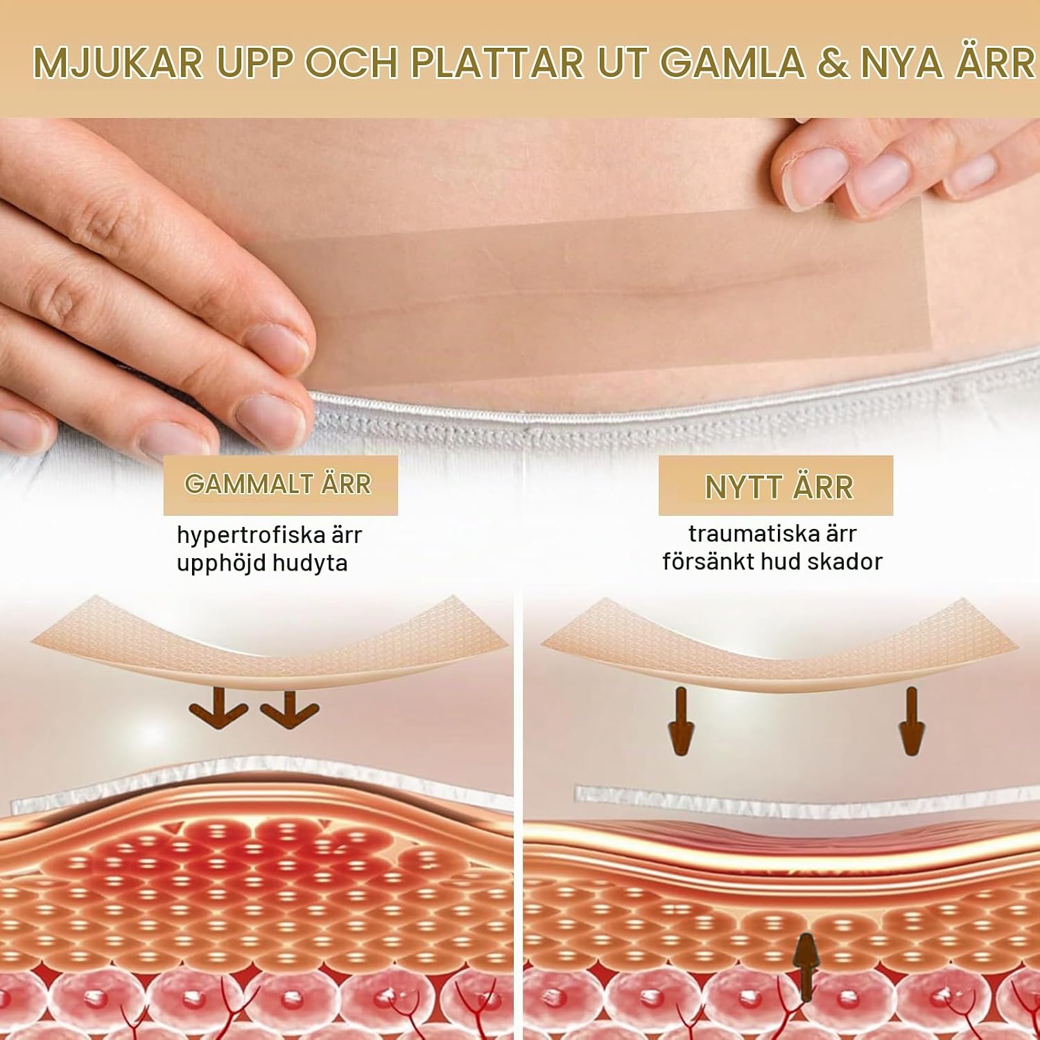 Detalle de GTAGKOMMEN silikonärrtejp 4 cm x 300 cm – tvättbar och återanvändbar