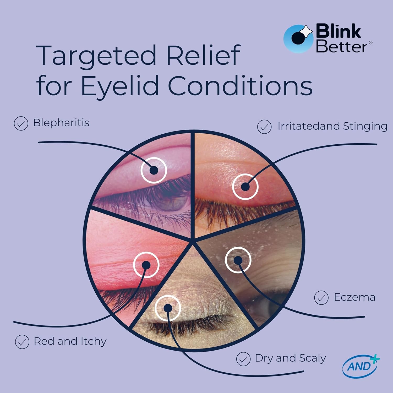 Detalle 1 de BlinkBetter BetterLids Eyelid Ointment 0.34 oz