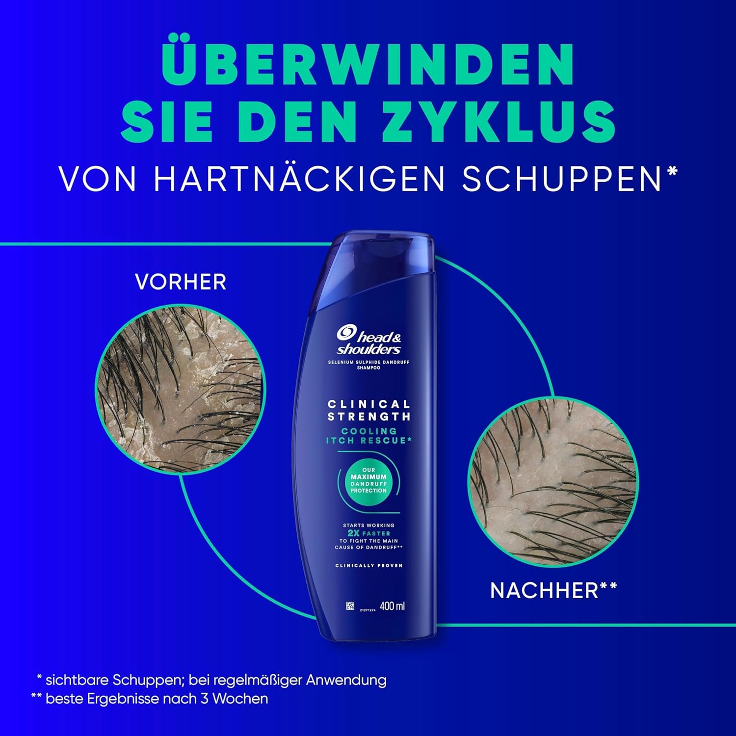 Detalle de Head & Shoulders Cooling Itch Rescue Anti-Schuppen Shampoo 400 ml