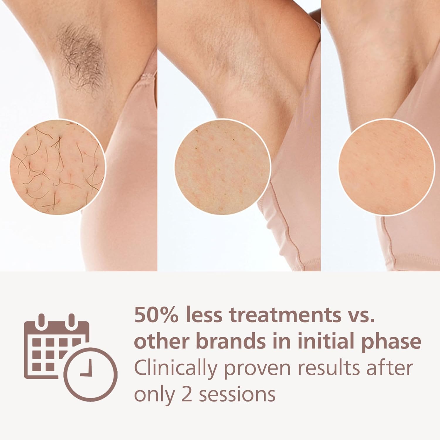 Thumbnail 3 de Philips Lumea 9900 Series IPL hair removal device (BRI953/02) with SenseIQ and SkinAI