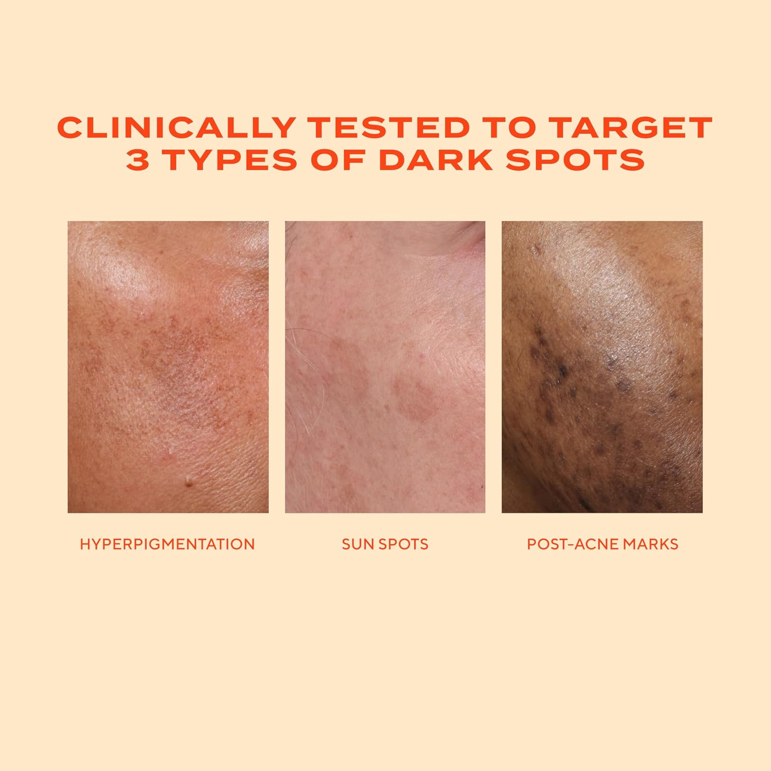 Detalle de Murad Rapid Dark Spot Correcting Serum with Glycolic Acid (30ml) – Environmental Shield