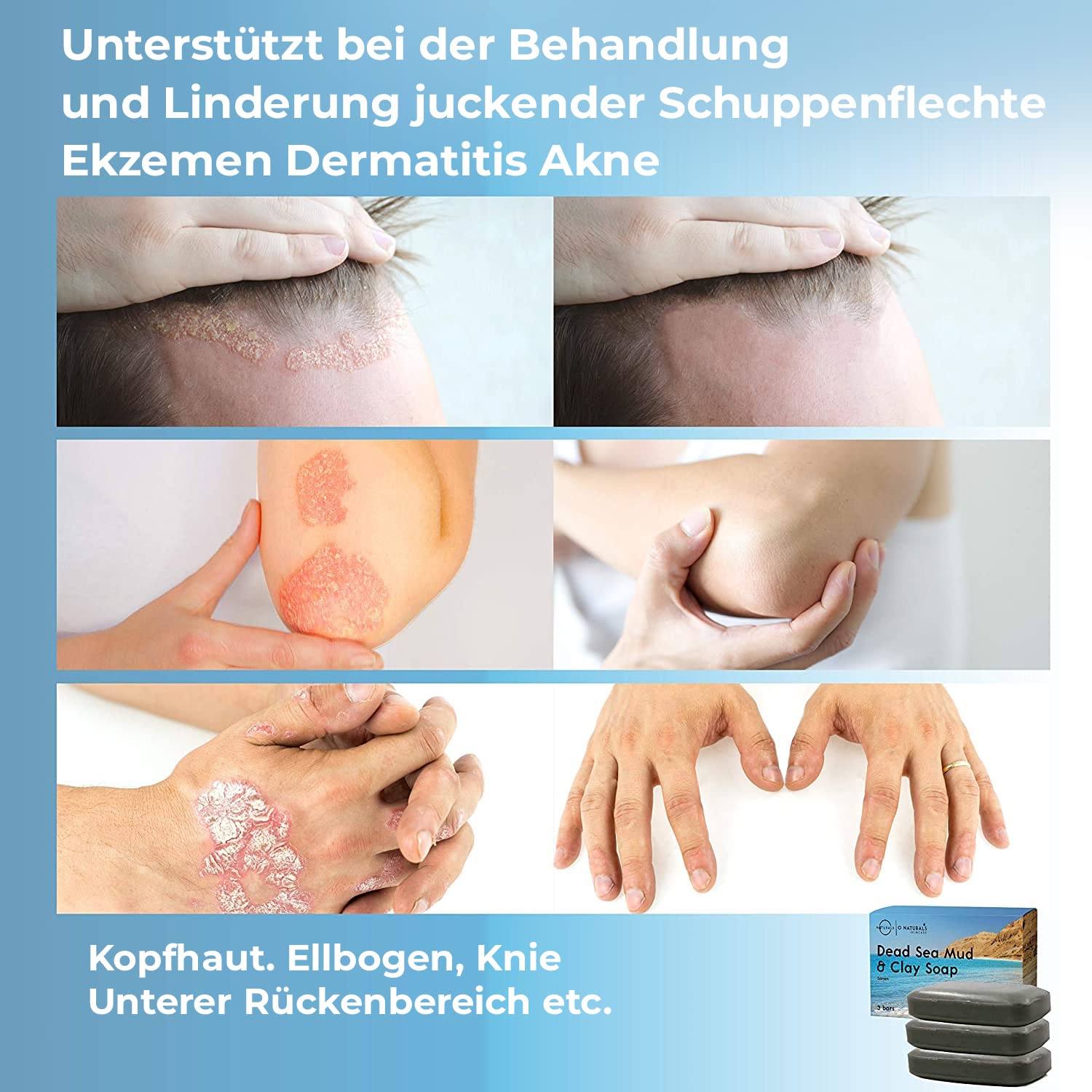 Thumbnail 2 de O NATURALS Totes Meer Schlamm & Lehm Seife (x3) – vegane Gesichtsseife mit Peeling- & Reinigungswirkung