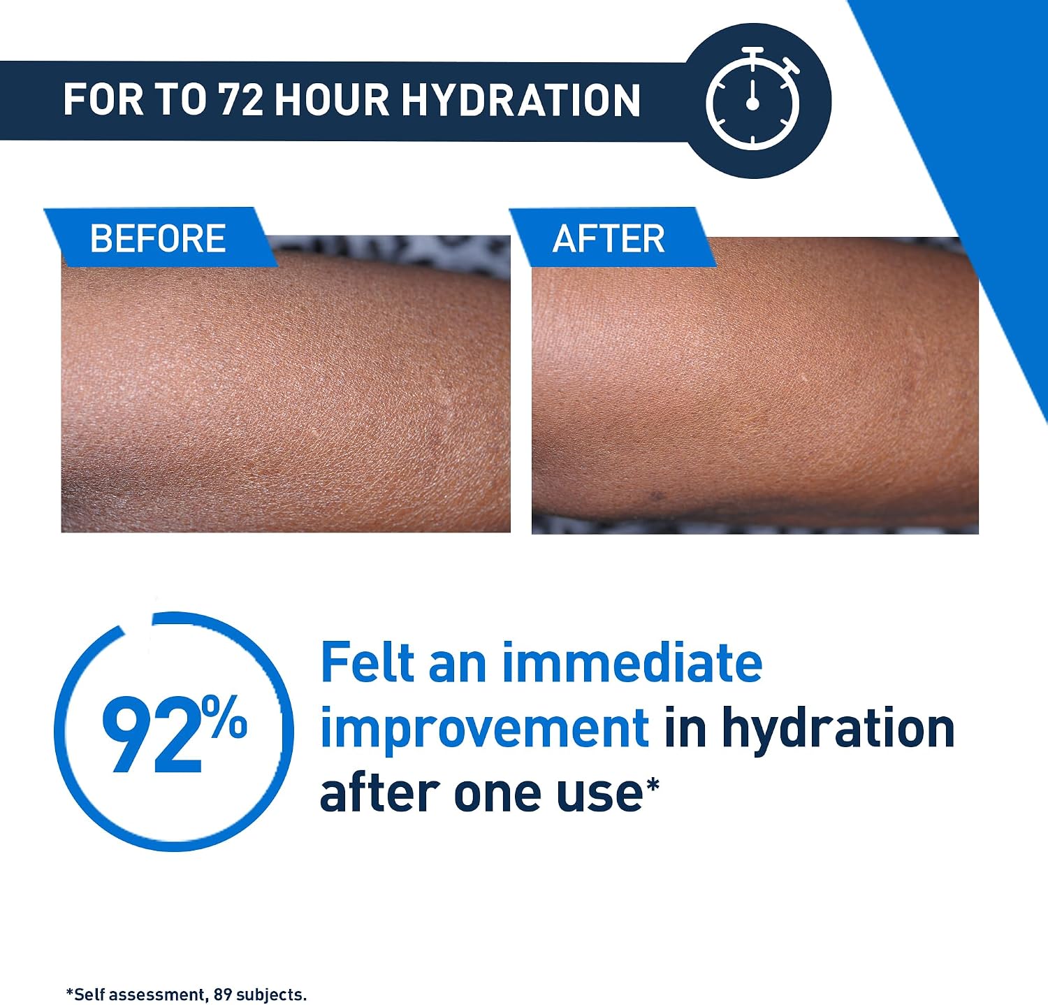 Thumbnail 6 de CeraVe Intensive Moisturising Lotion 5%