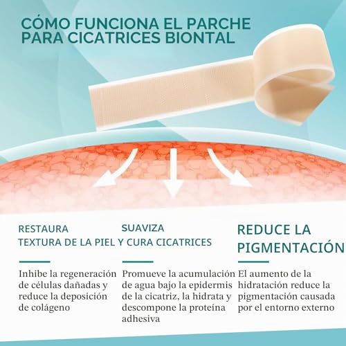 Detalle 2 de NVXNMSD Silicone Scar Sheets: Parches de Silicona para Cicatrices Verdes, 1.6'' x 60