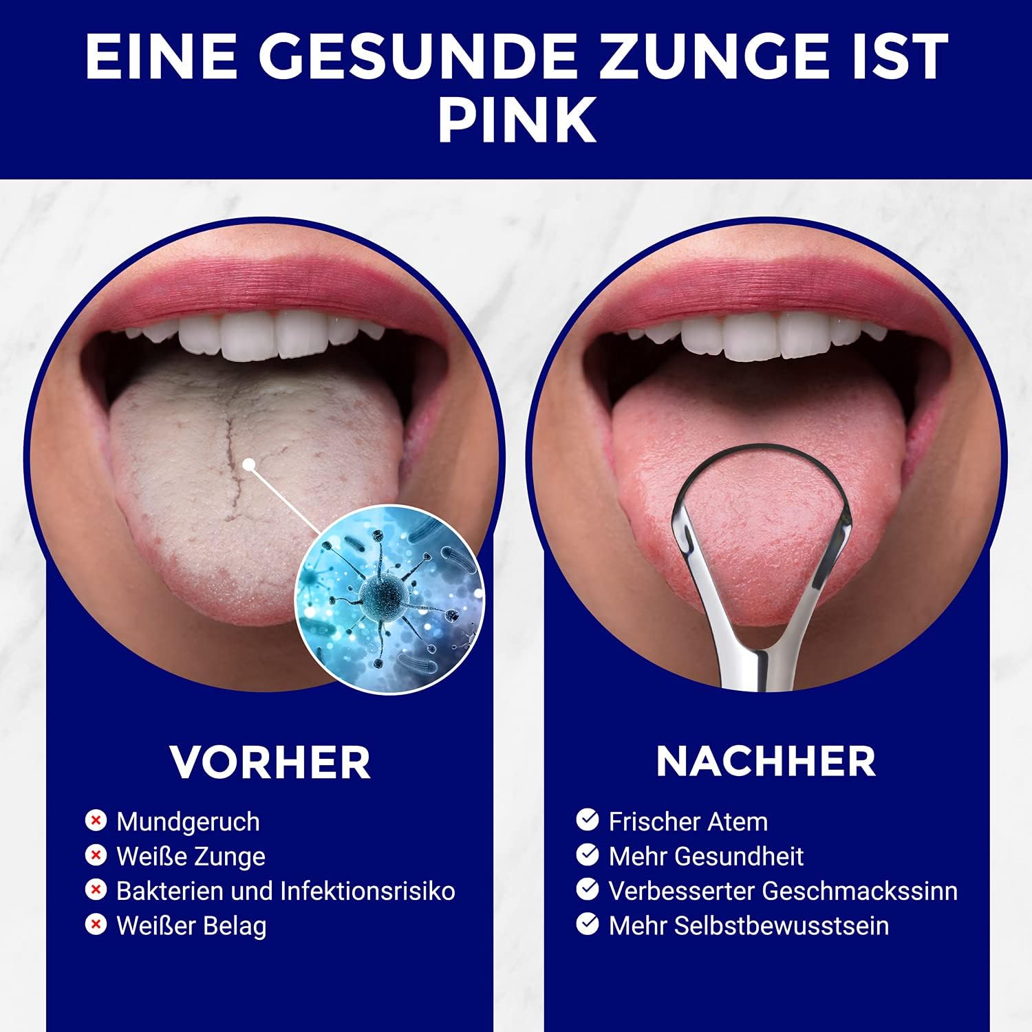 Detalle 2 de ORAVIX Zungenschaber Edelstahl – Zungenreiniger Set aus Edelstahl