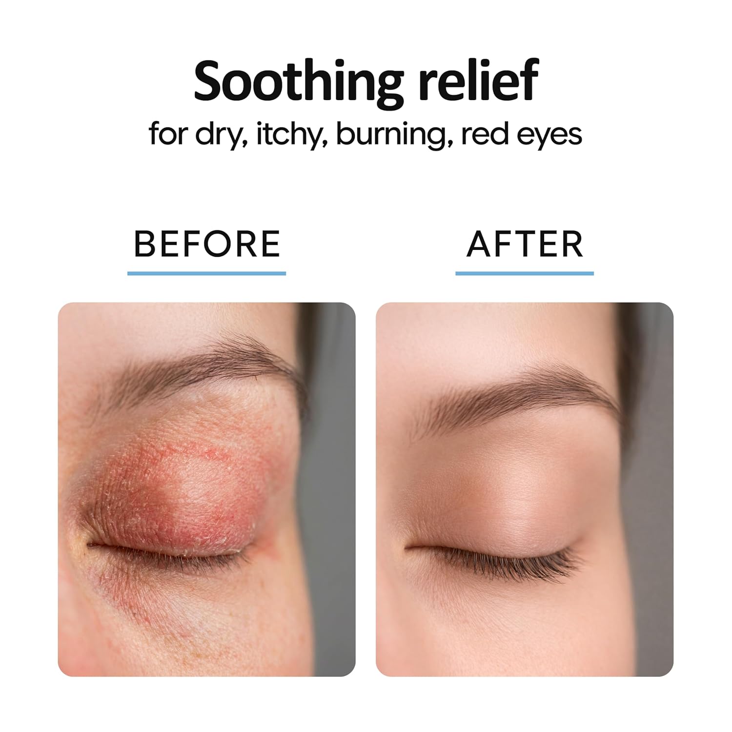 Detalle de Eyelid Cleanser Spray 8oz — Hypochlorous Eye Cleanser for Blepharitis, Stye, and Demodex