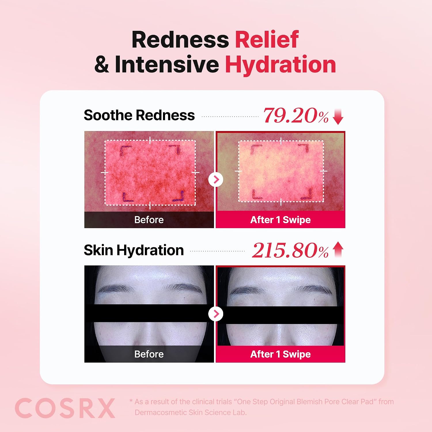 Thumbnail 3 de COSRX One Step Original Blemish Pore Clear Pad – 100 Dual-Sided Exfoliating Pads