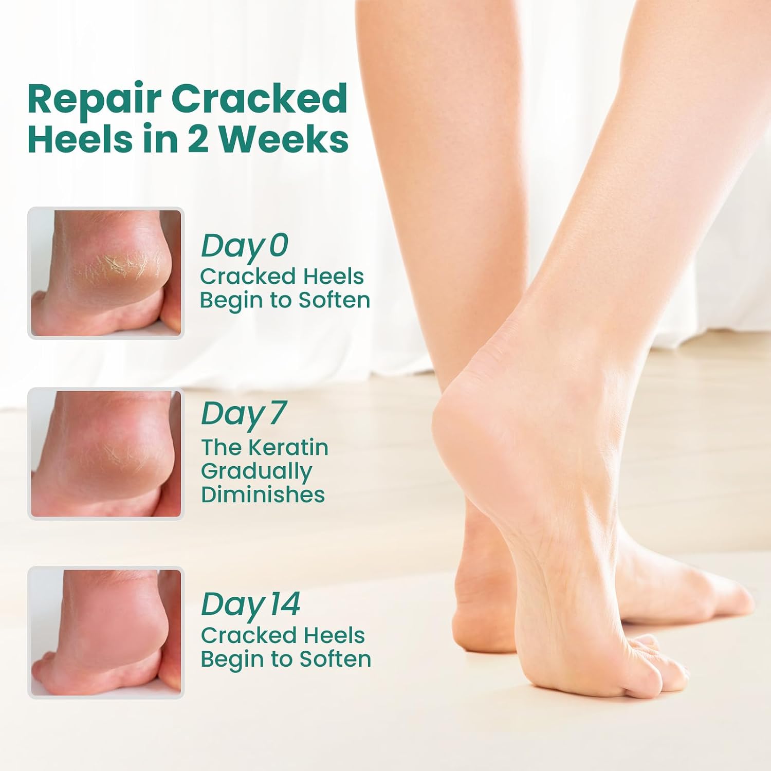 Thumbnail 1 de Welnove Moisturizing Heel Socks 2 Paar Aloe