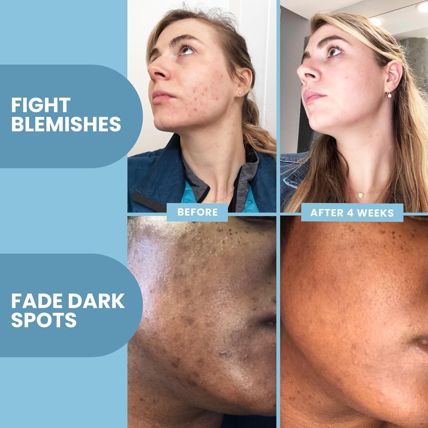 Thumbnail 6 de Eva Naturals Vitamin C Serum for Face (Retinol, Hyaluronic Acid, Niacinamide & Salicylic Acid) – 1 fl oz