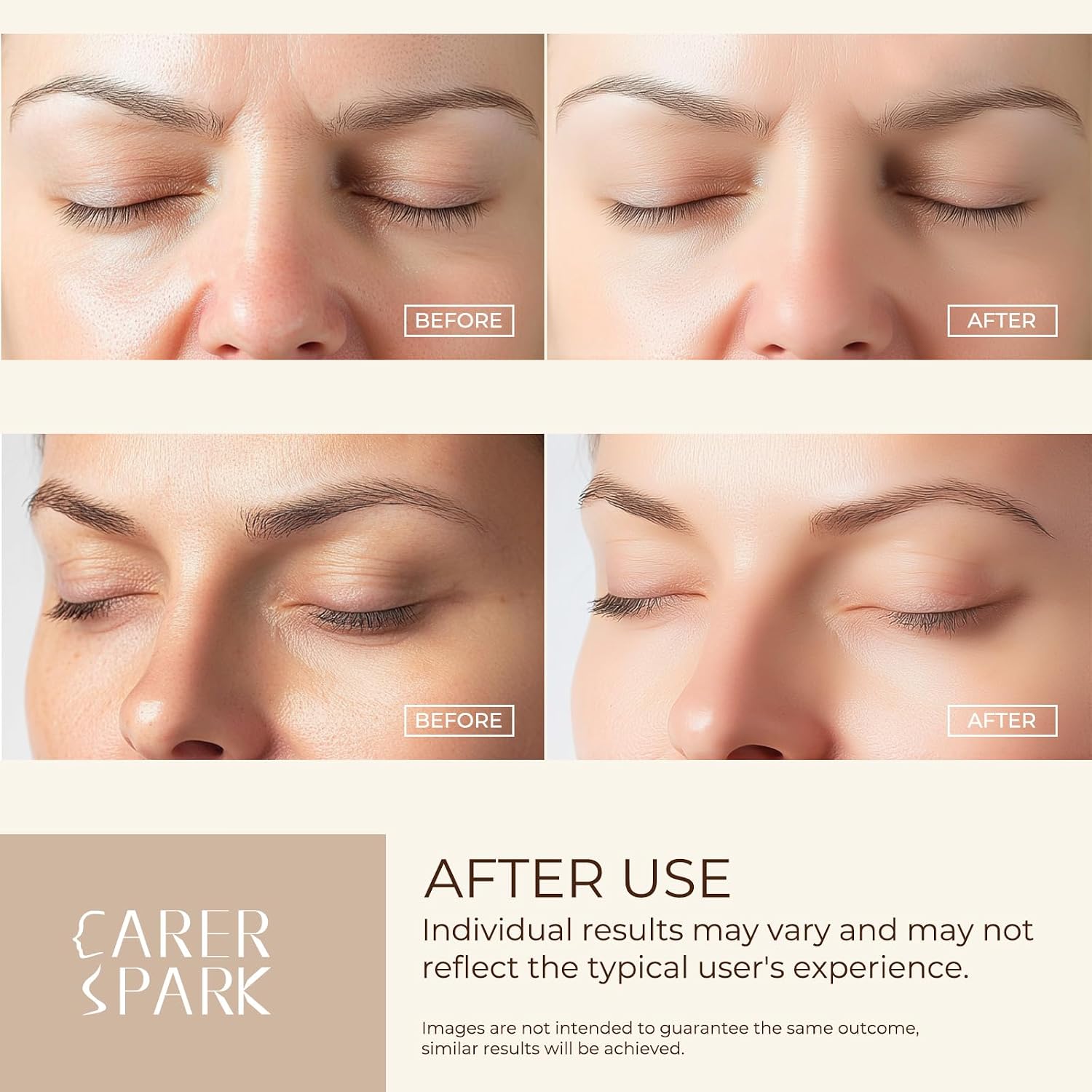 Detalle de CARER SPARK Ultrasonic Facial Scrubber with EMS, Ion Modes and Red & Blue Light