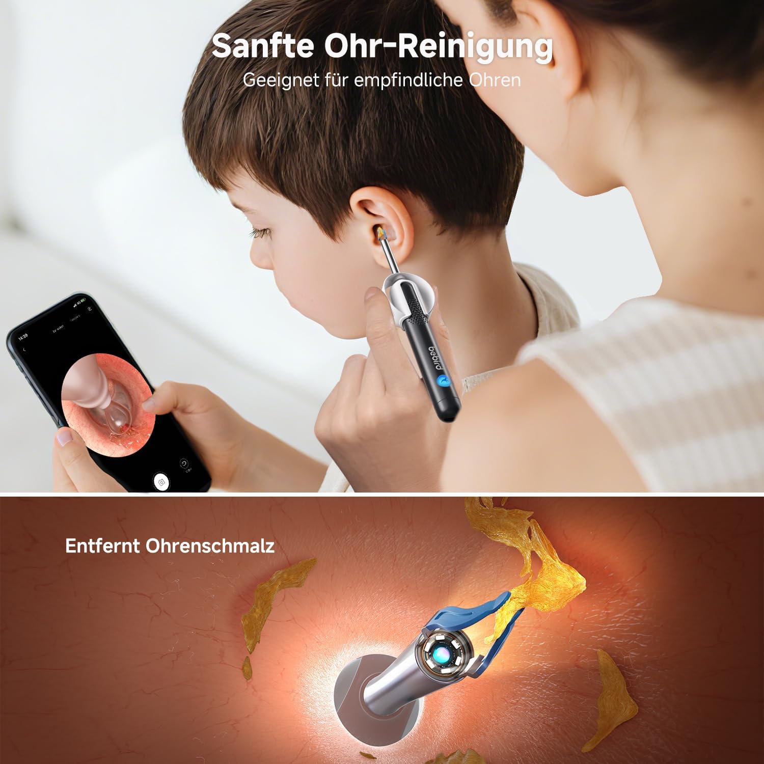Thumbnail 1 de BEBIRD R1 Ultra Ohrenschmalz-Entferner Otoskop für Zuhause