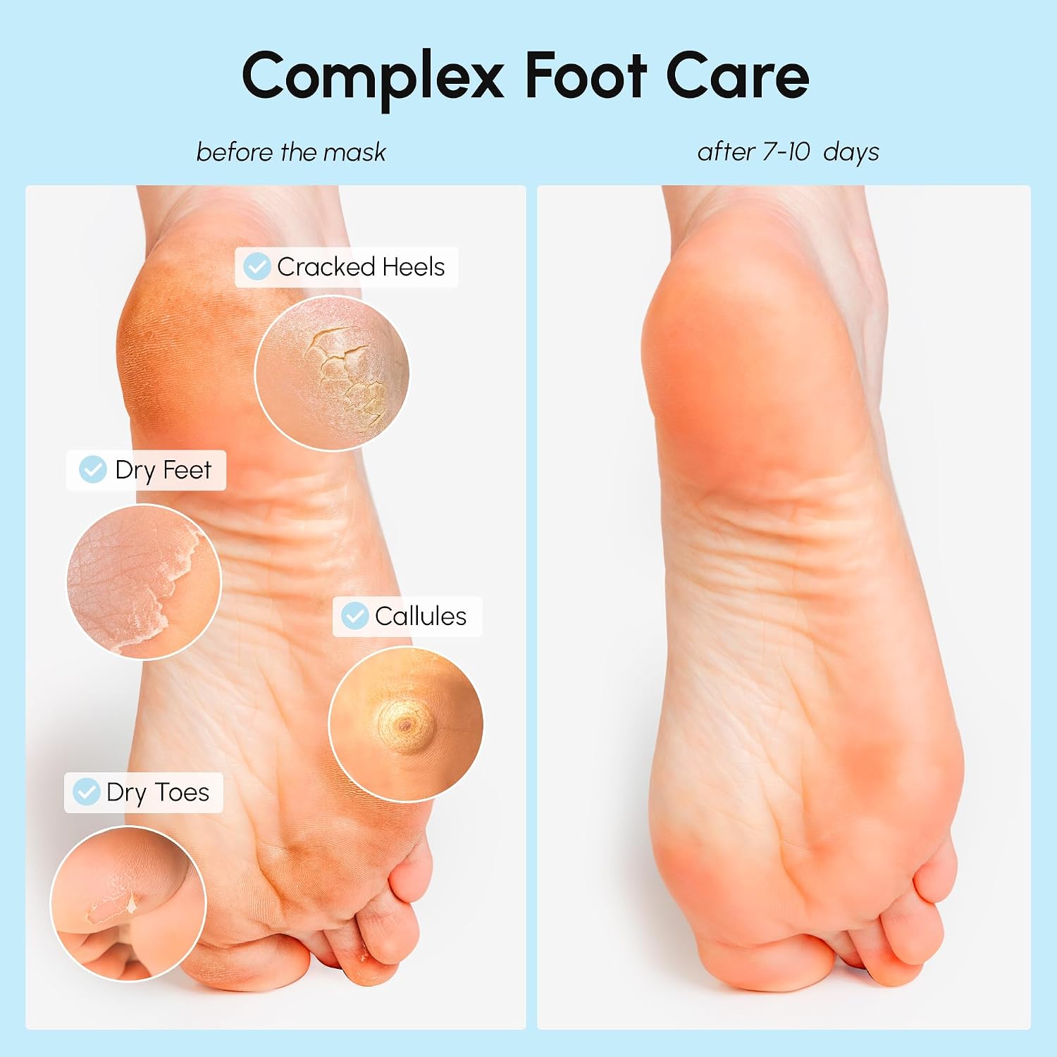 Detalle de MAREE Foot Peeling Mask 3-in-1 for Dry Feet