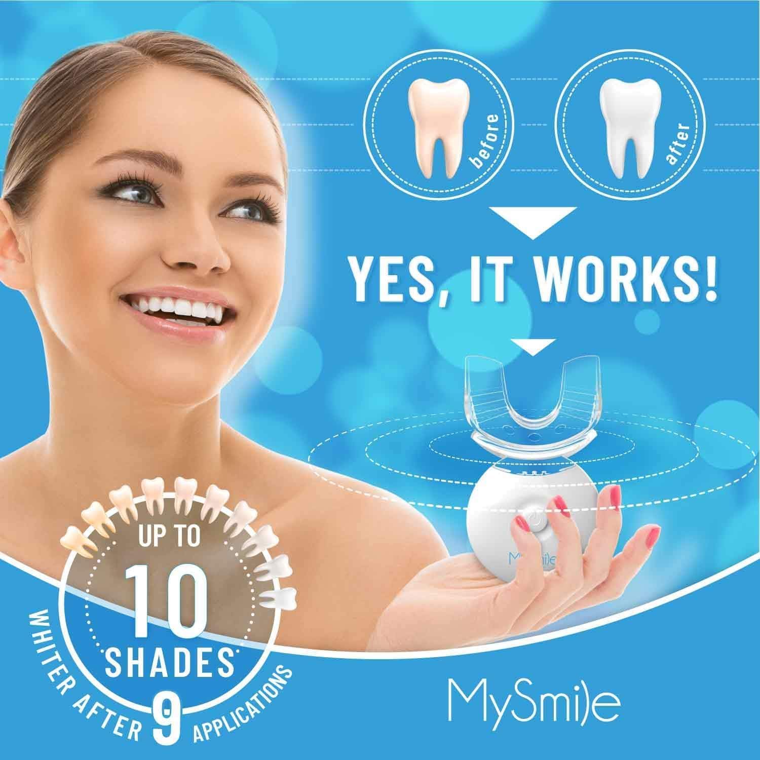 Detalle 2 de MySmile Teeth Whitening Kit 35% 🦷