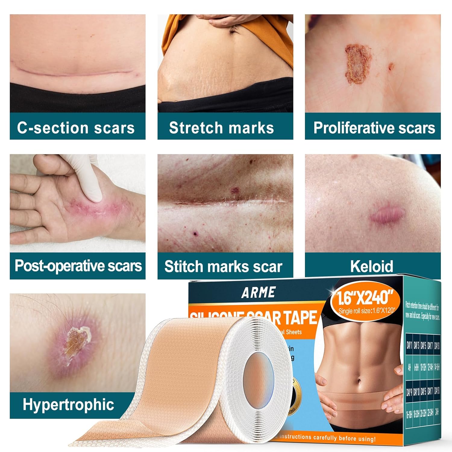 Thumbnail 5 de Arme Silicone Scar Tape: 2 rolls of 1.6" x 120" medical grade silicone scar sheets