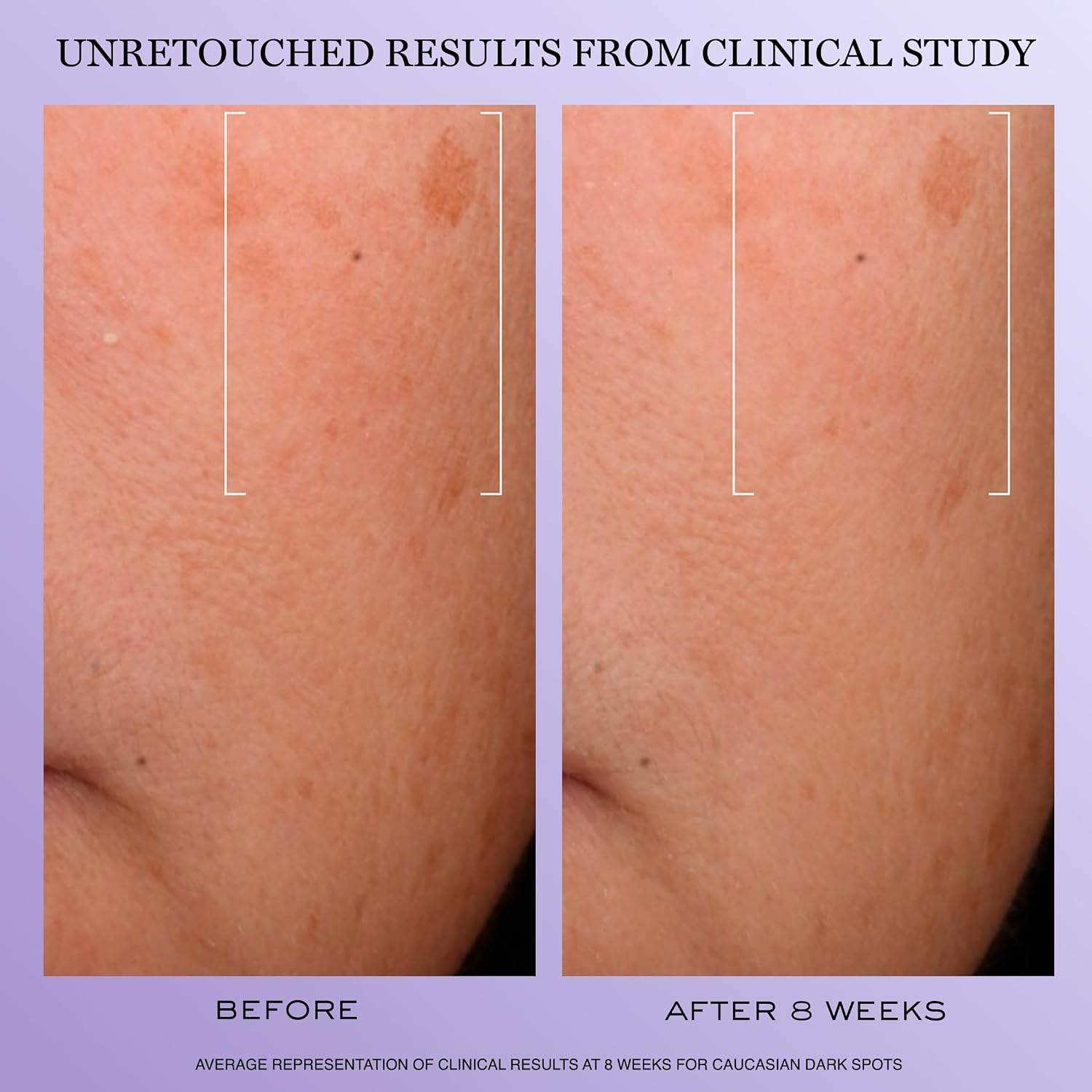 Detalle 2 de Lancôme Rénergie H.C.F. Triple Serum 3614272860377, Face Serum with Hyaluronic Acid