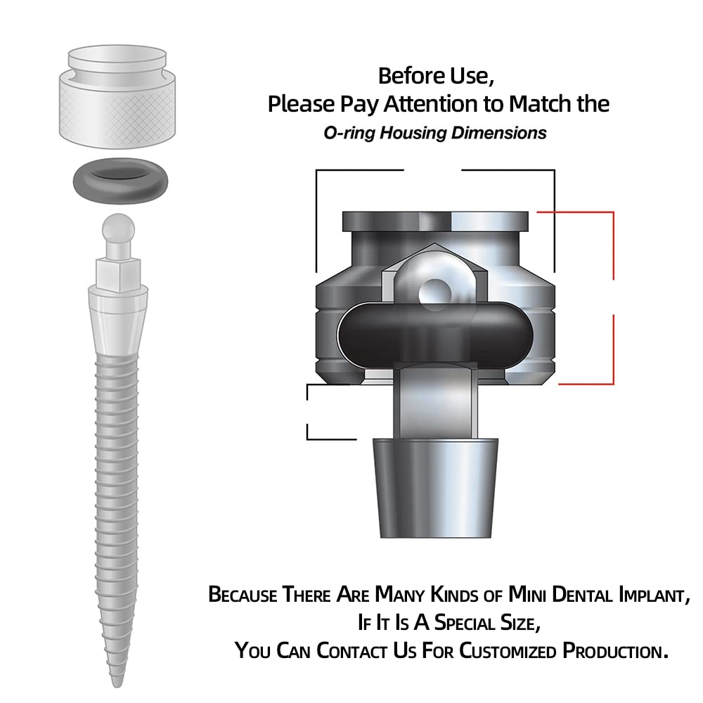 Thumbnail 2 de FUSHIPRO Oリング Buna-N 3サイズセット ミニデンタルインプラント交換用、取付工具付き