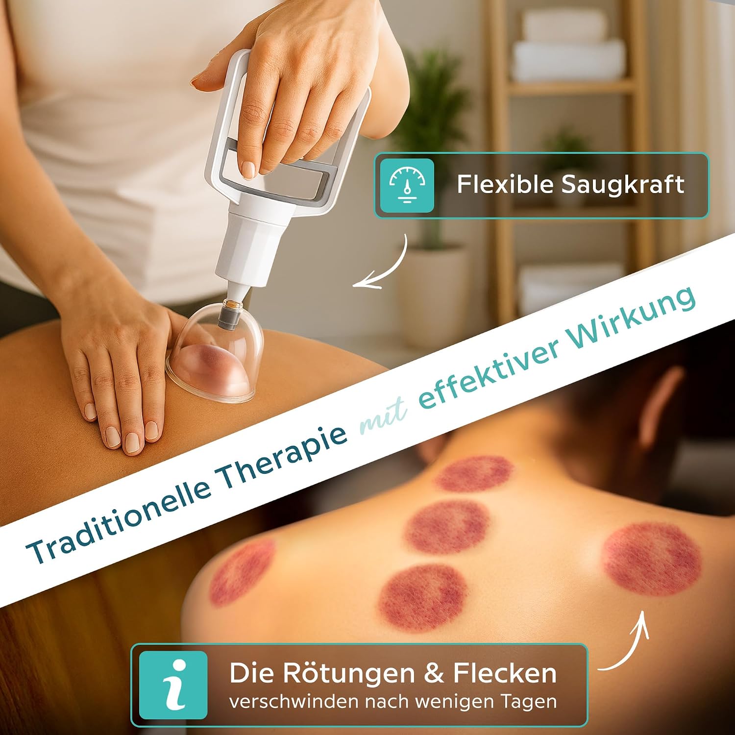 Detalle de KURGLAS Schröpfgläser mit Vakuumpumpe (24 Stück) – Schröpfset aus Kunststoff mit Therapiemagneten & Faszienschaber