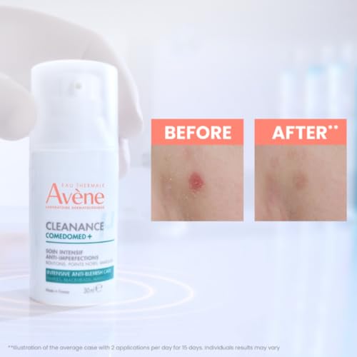 Detalle de AVÈNE Cleanance Comedomed+ Intensiv-Konzentrat 30 ml – Gegen Unreinheiten mit Comedoclastin