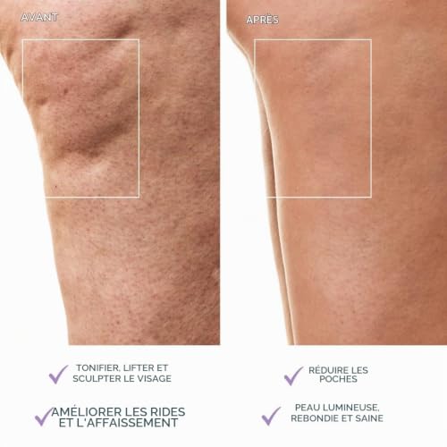 Detalle 2 de FOREO BEAR 2 body – Appareil de massage corps sculptant à micro-courant avancé