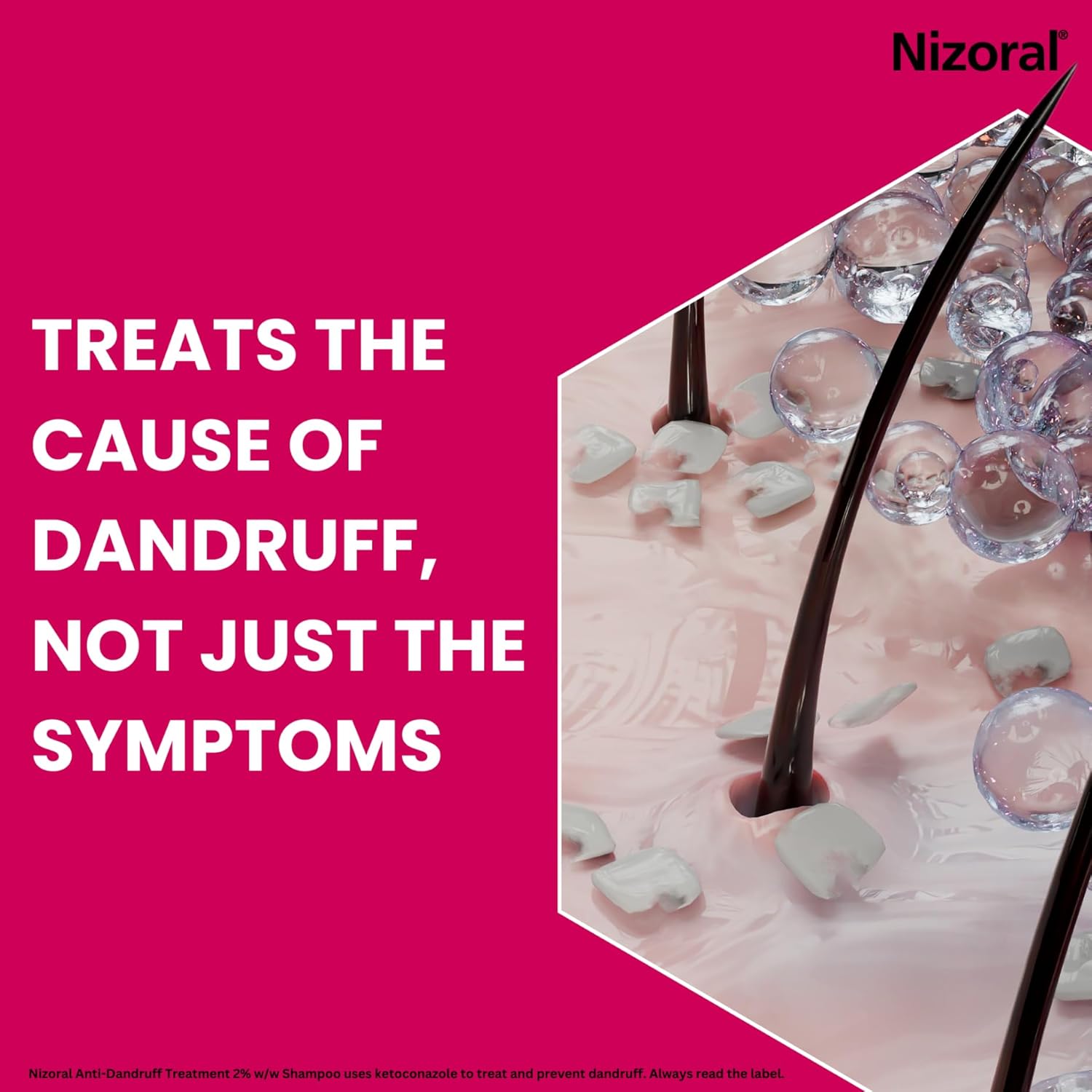 Thumbnail 2 de Nizoral Anti-Dandruff Treatment Shampoo (1 x 100ml) — Clinically proven for itchy, flaky scalps