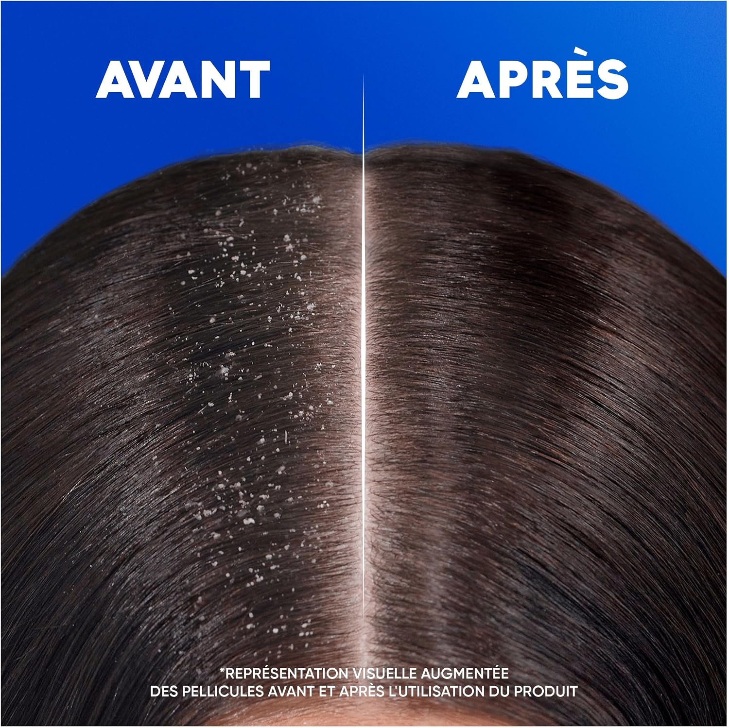 Detalle 2 de Head & Shoulders 800 ml shampoing antipelliculaire