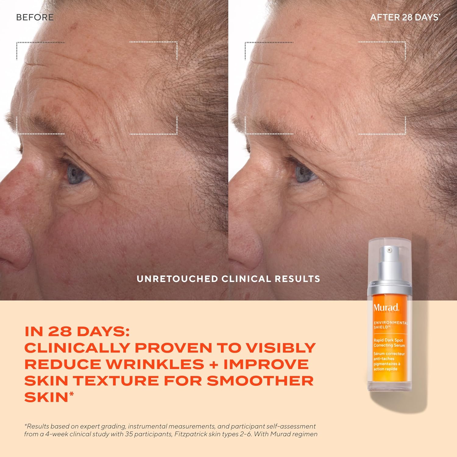 Detalle de Murad Rapid Dark Spot Correcting Serum with Glycolic Acid (30ml) – Environmental Shield
