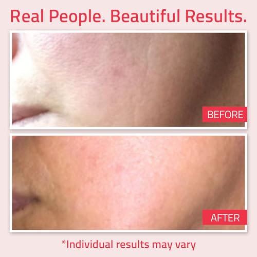 Detalle de YEOUTH Crema Retinol con Ácido Hialurónico y Ginseng
