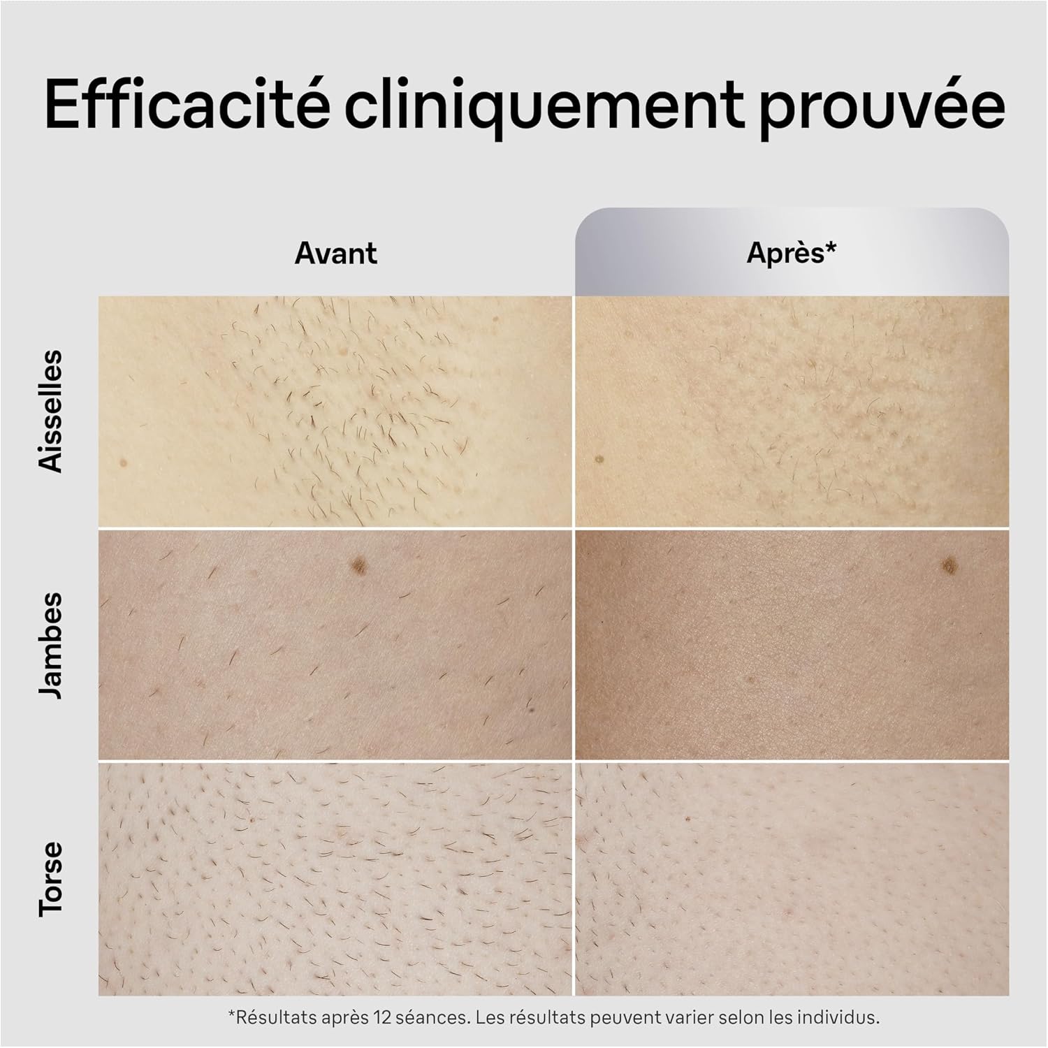 Thumbnail 5 de Braun Silk·expert Pro 5 épilateur lumière pulsée, résultats en 2 séances ⚕