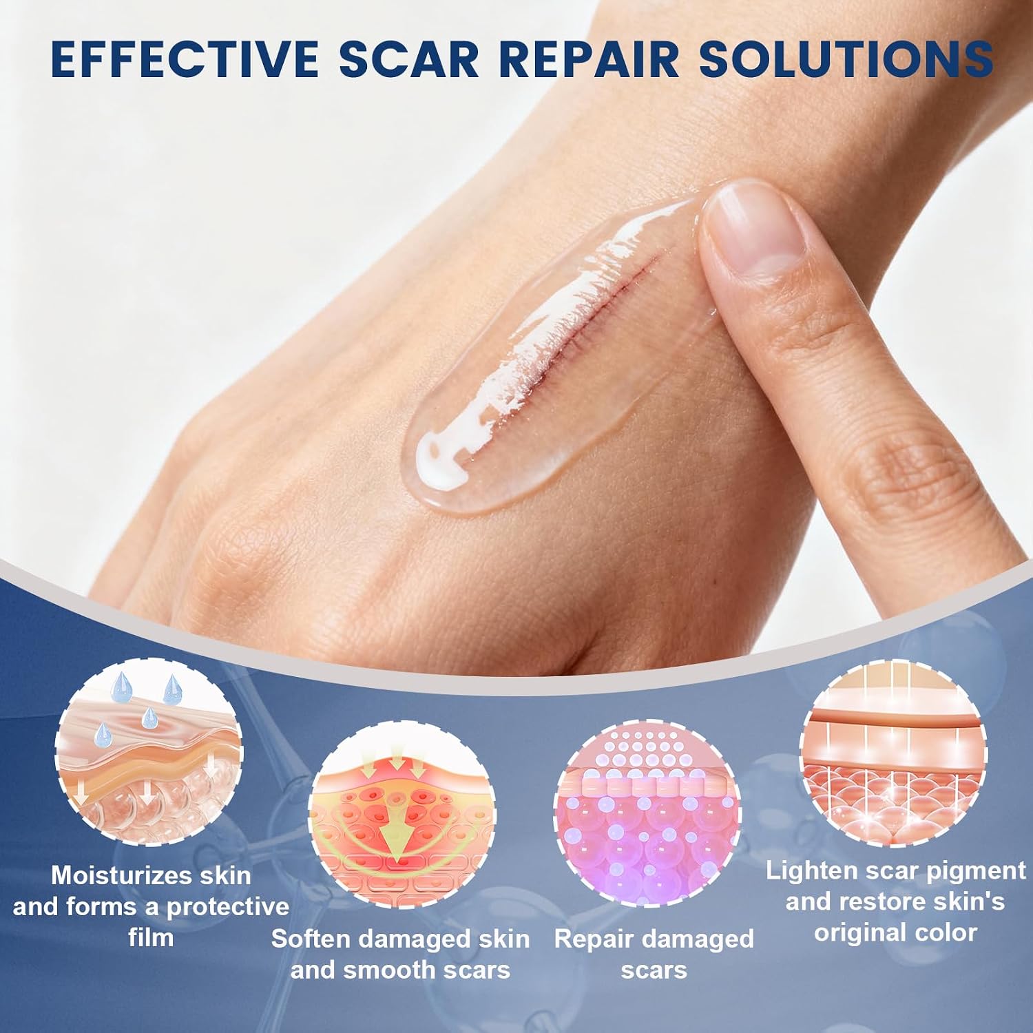 Thumbnail 4 de Rvlaim 100% Silicone Scar Gel Scar Cream (Advanced Silicone Gel) 1.7 oz/50 ml