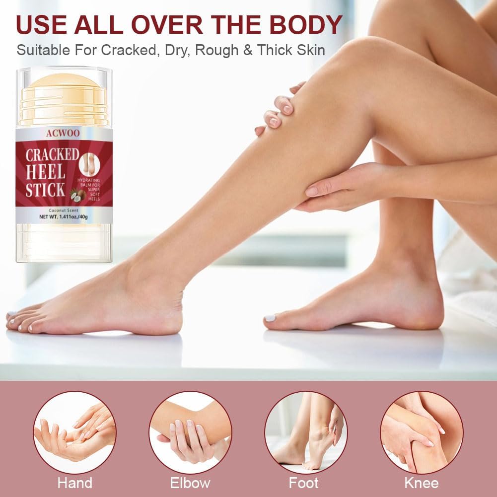Detalle 2 de ACWOO Foot Cream – urea foot moisturiser for cracked heels and dry, rough skin
