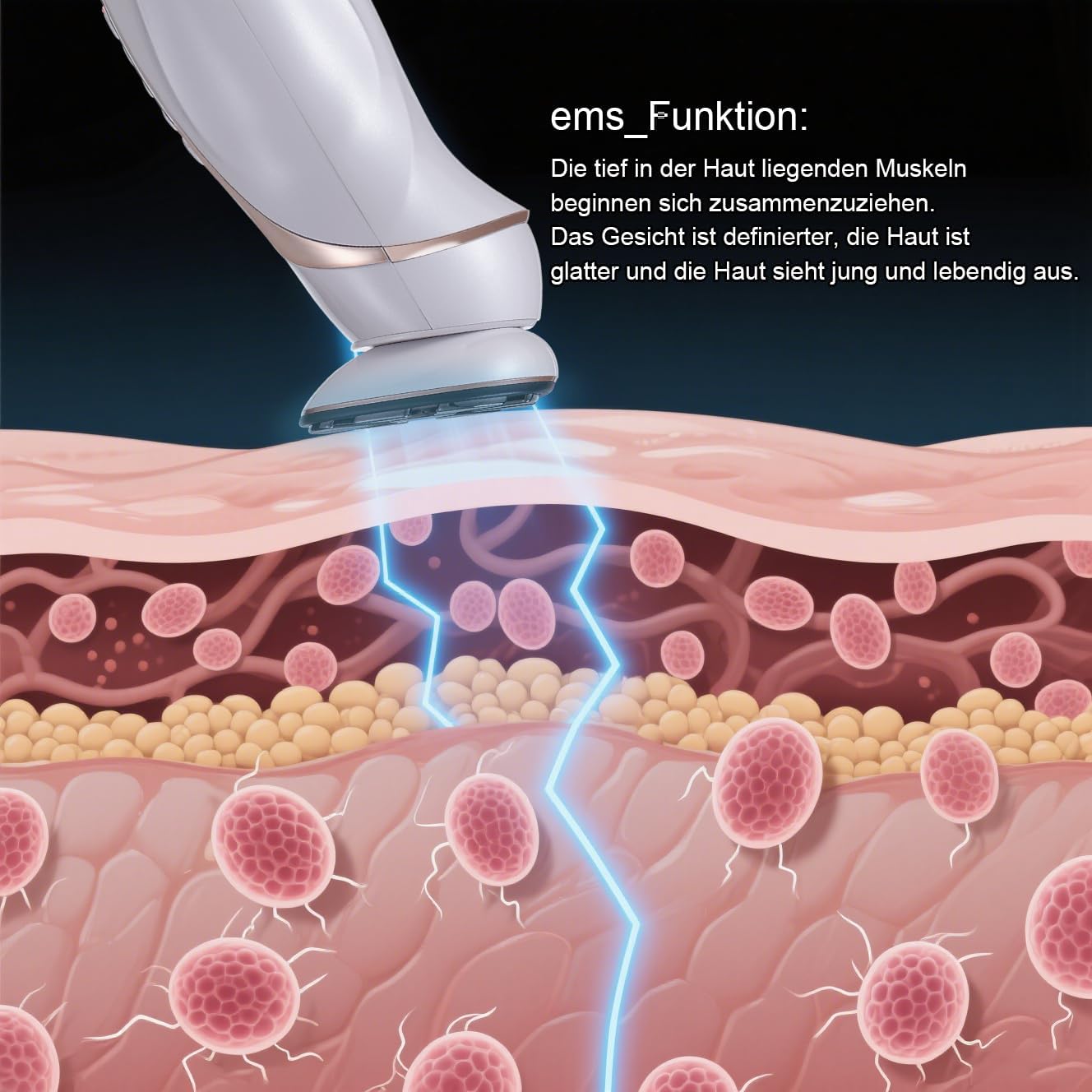 Detalle de JMFBeauty Dispositivo di radiofrequenza RF_EMS_VR per la casa – Cura viso e corpo con luce LED multipla