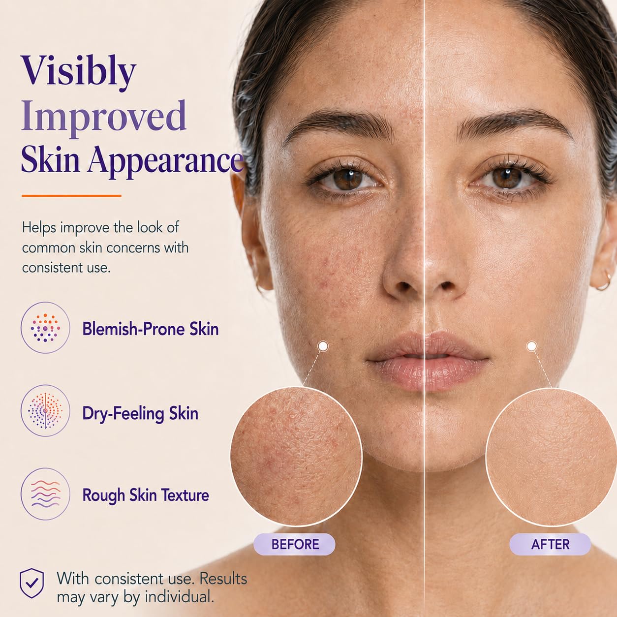 Thumbnail 6 de Facial Cream with Azelaic Acid