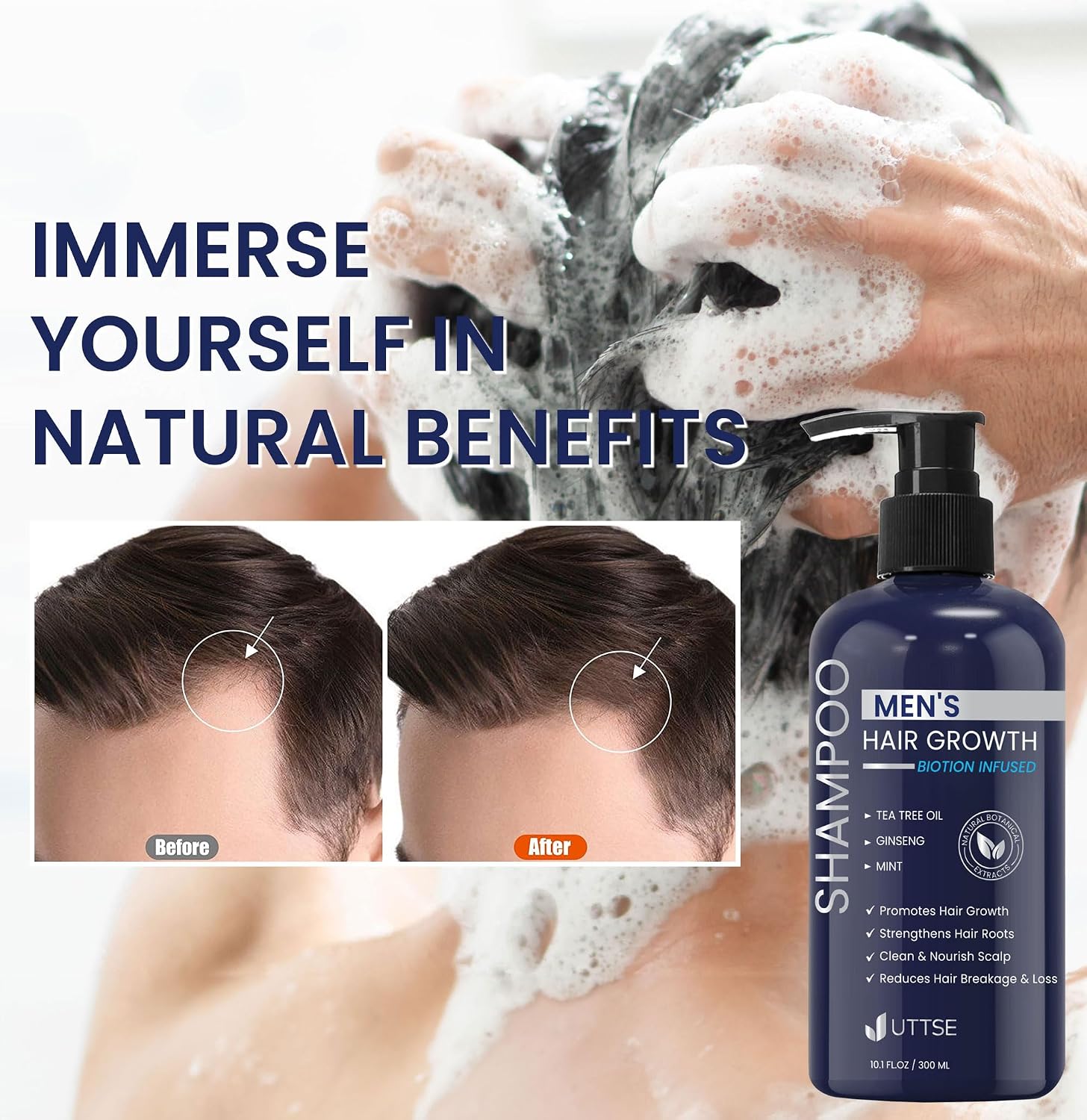 Thumbnail 5 de Uttse Biotion Hair Growth Shampoo with Tea Tree Oil and Ginseng Mint, 10.1 fl.oz ⚙