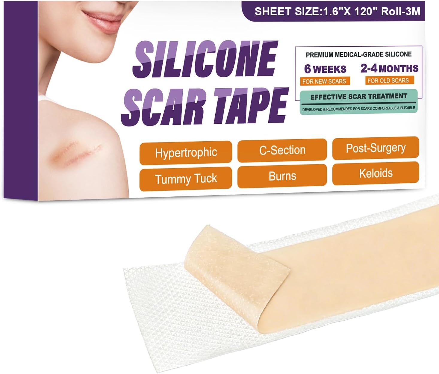 Psecici Medical-Grade Silicone Scar Tape review: 4cm x 3M for C-sections, tummy tucks and scars