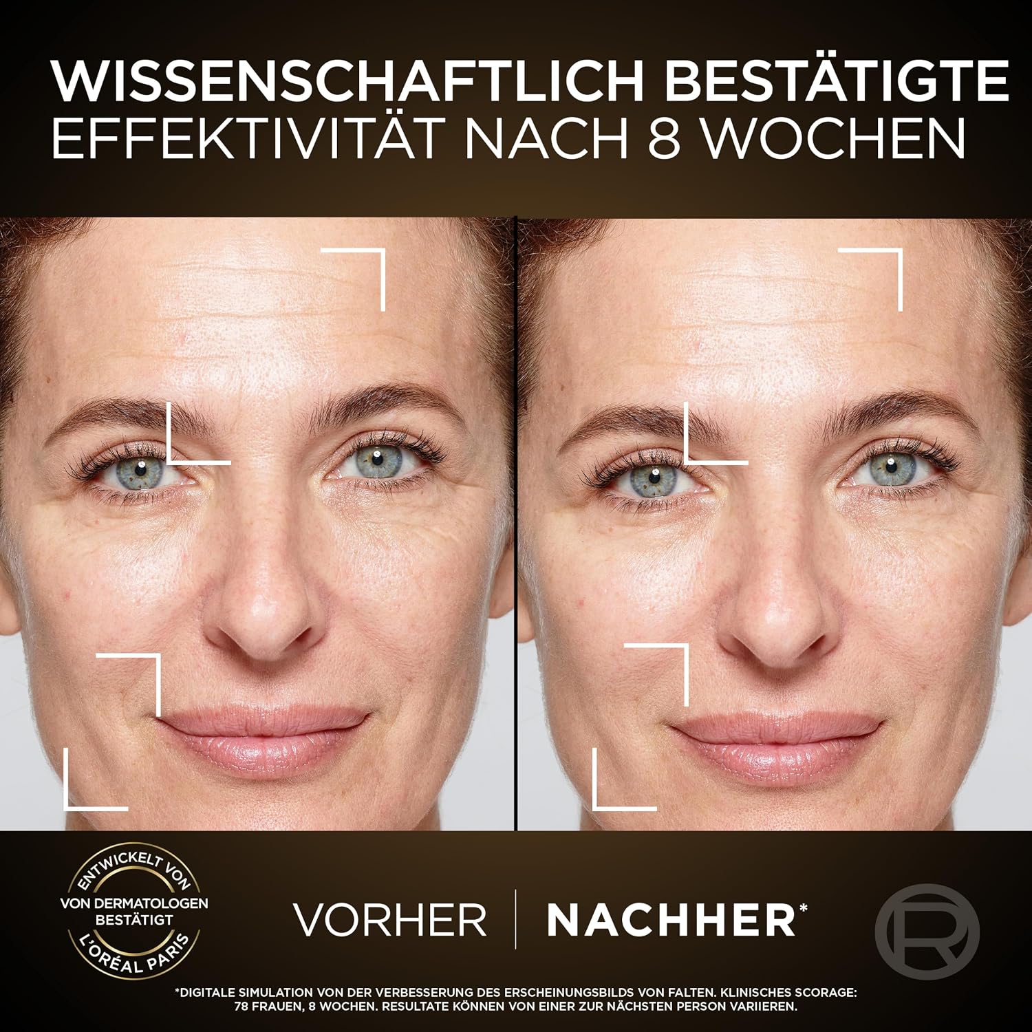Thumbnail 4 de L'Oréal Paris Age Perfect Zell Renaissance Gesichtspflege-Set – Anti-Aging Tages- und Nachtpflege, 2 × 50 ml