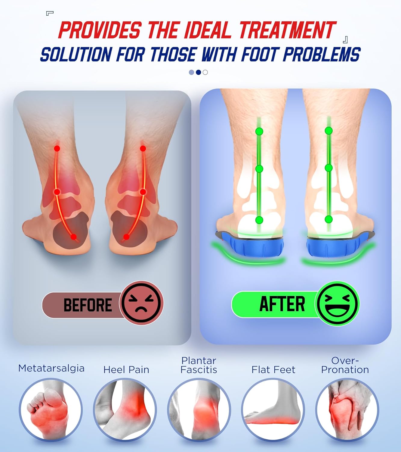 Detalle 2 de NEUPU Heavy Duty High Arch Orthotic Insoles 240+ lbs