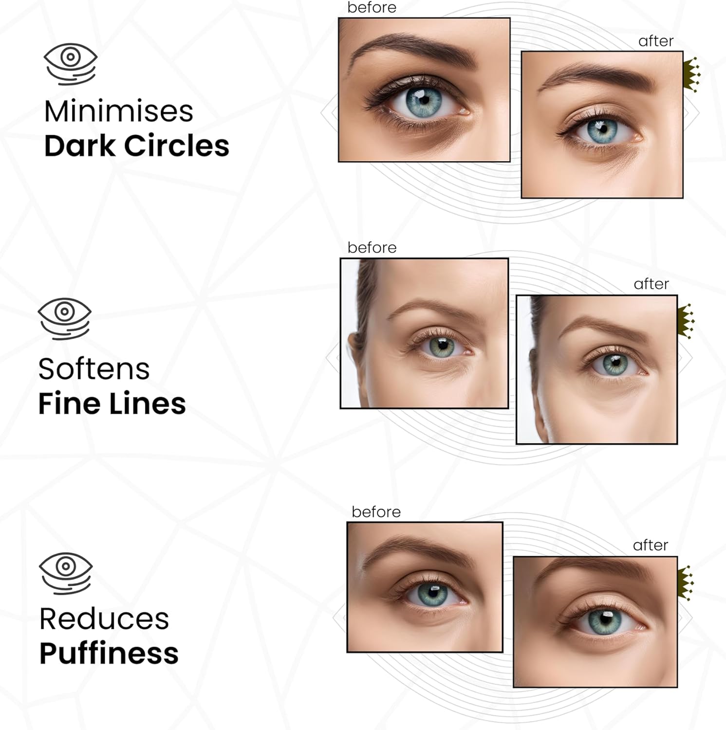 Thumbnail 2 de Revitale Pure Vegan Under Eye Patch – Cerotti sotto gli occhi lenitivi, 10 coppie