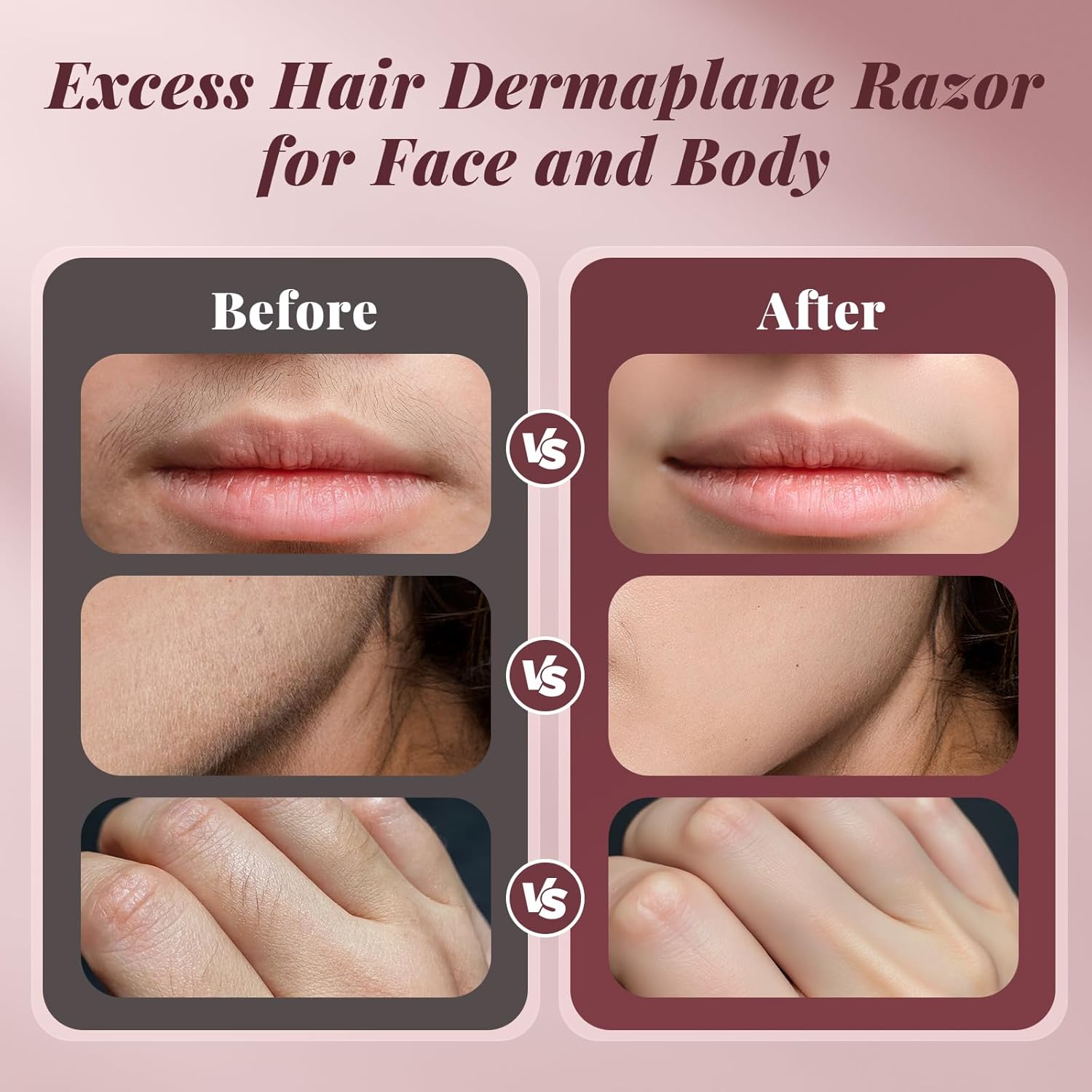 Thumbnail 6 de BNU Dermaplane Razor 3-Speed Rechargeable 💄