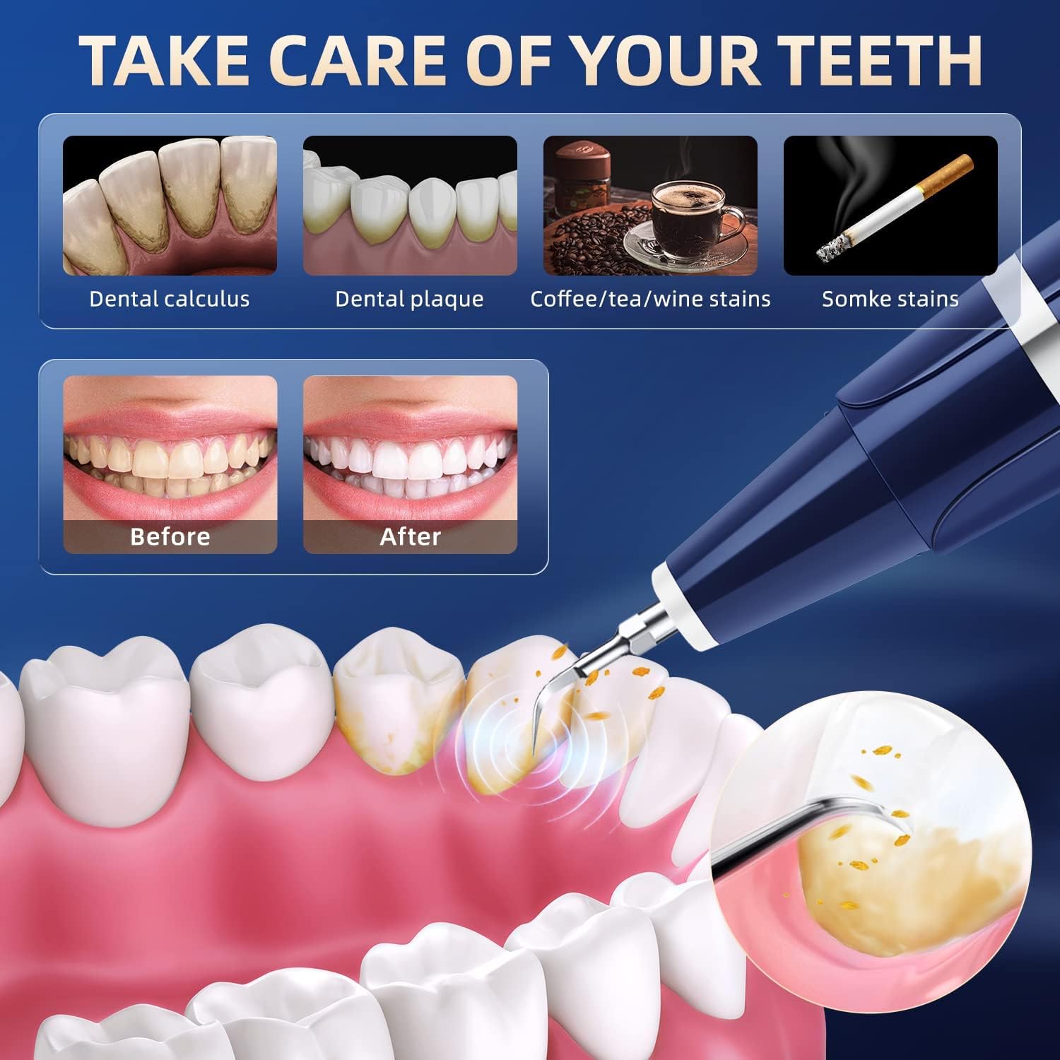 Thumbnail 2 de Plaque Remover 1500 mAh 🪥