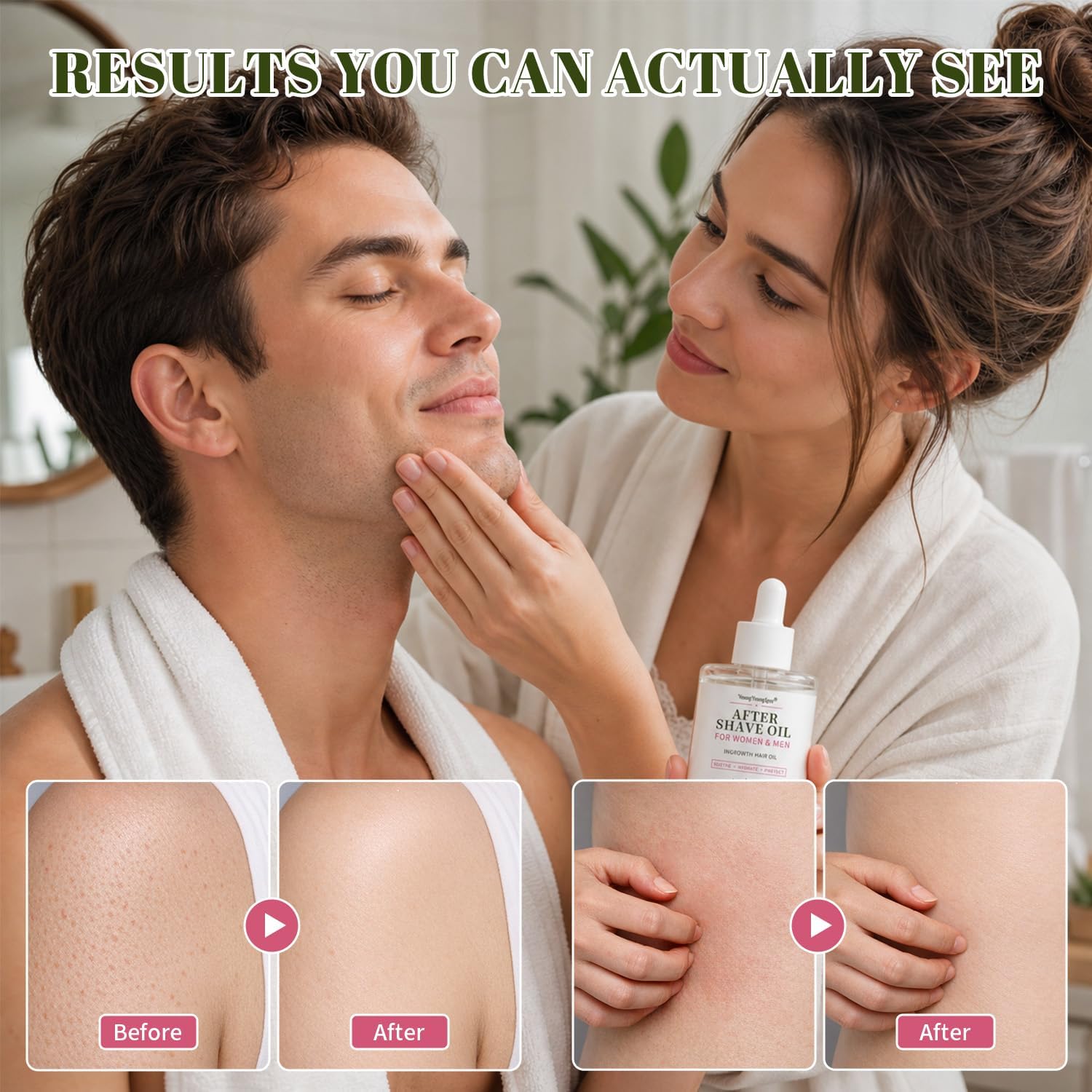 Detalle de YOUNGYOUNGLOVE After Shave Oil, 100 mL for Ingrown Hairs & Razor Bumps