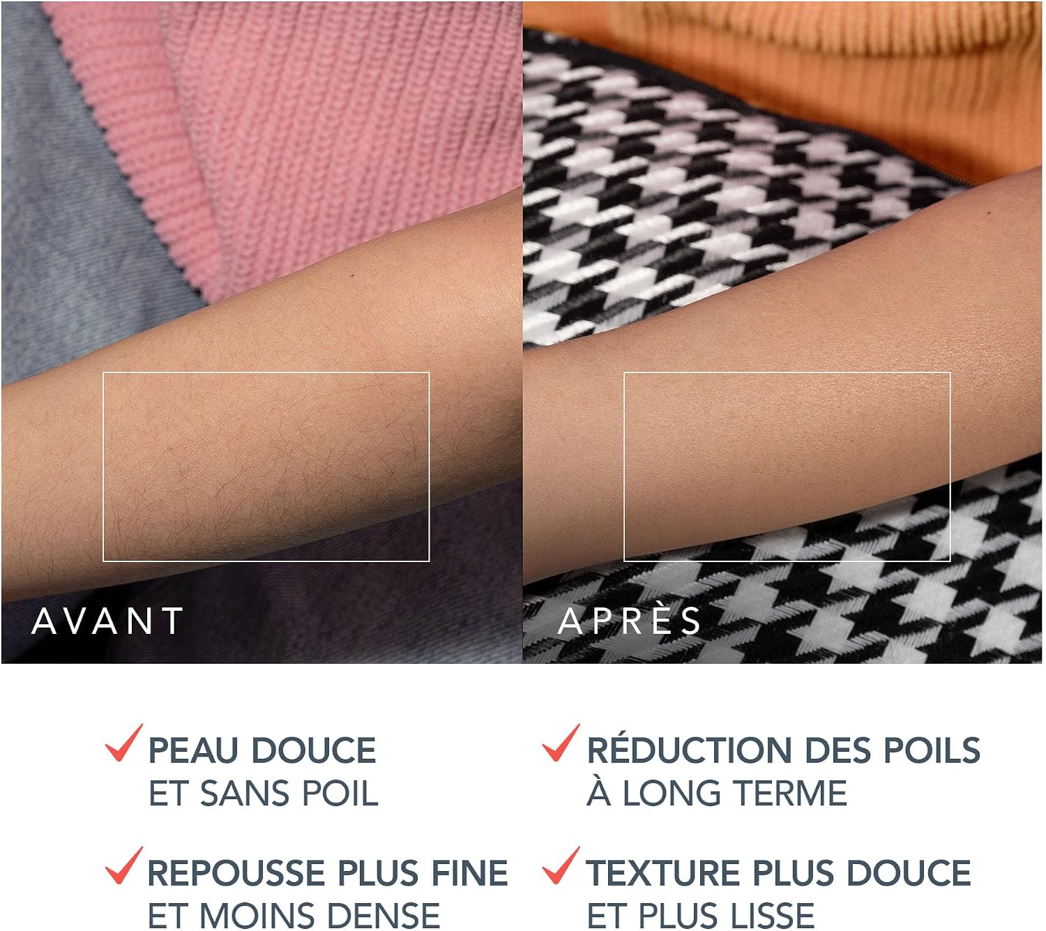 Thumbnail 4 de FOREO PEACH 2 Pro Max – Appareil IPL pour épilation visage & corps à domicile