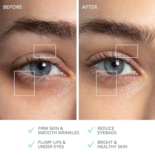 Thumbnail 4 de FOREO BEAR 2 eyes & lips – Appareil anti-rides à micro-courant pour yeux et lèvres