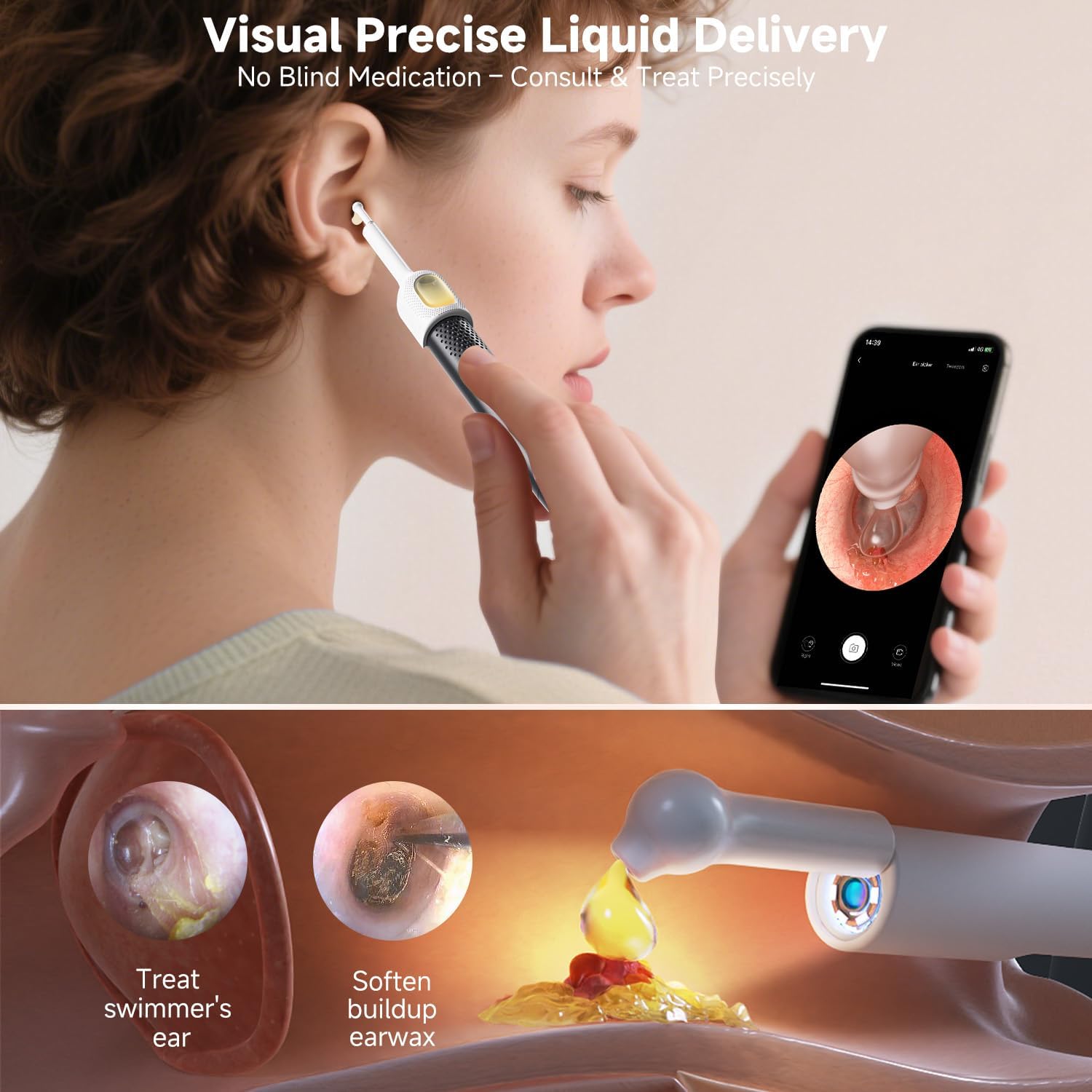 Thumbnail 4 de BEBIRD R1 Ultra Ear Wax Removal Kit with Camera Otoscope – UK assessment